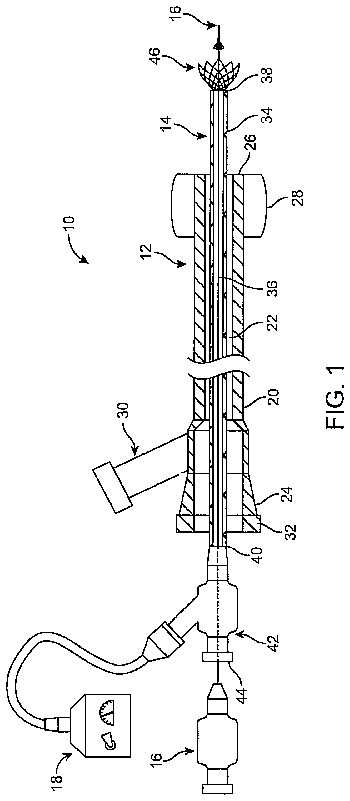 Patent US12096951 Figure 1 – System and method for treating ischemic stroke