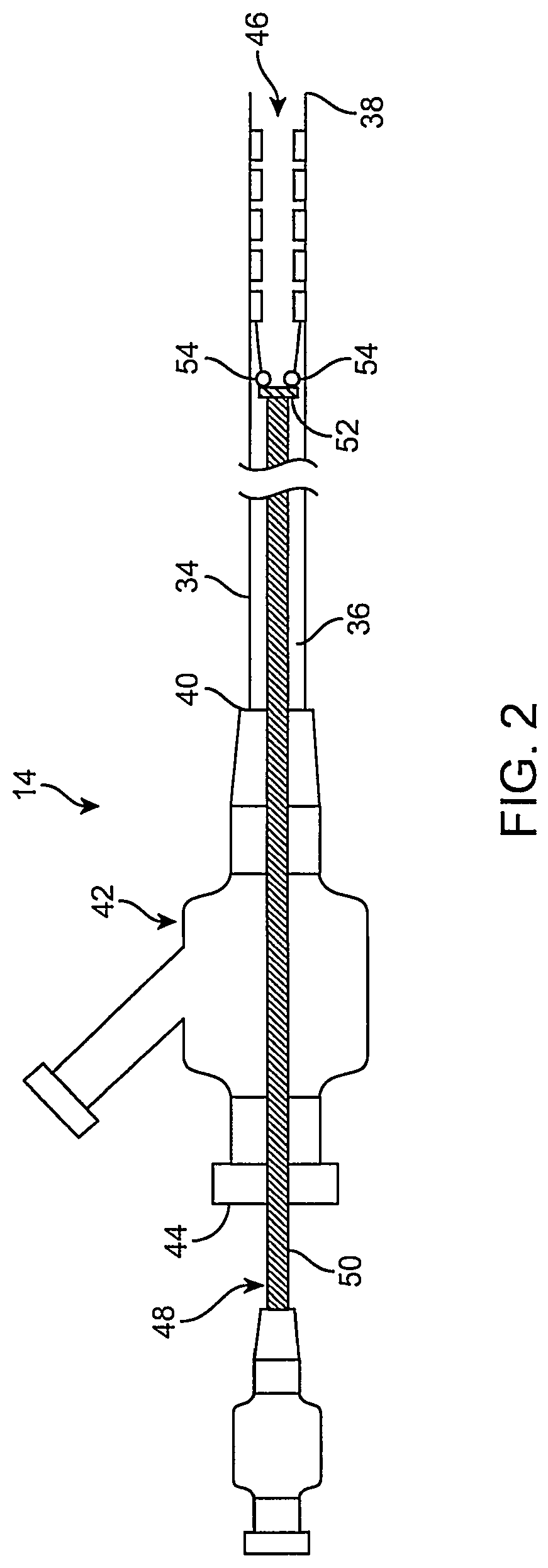 Patent US12096951 Figure 2 – System and method for treating ischemic stroke