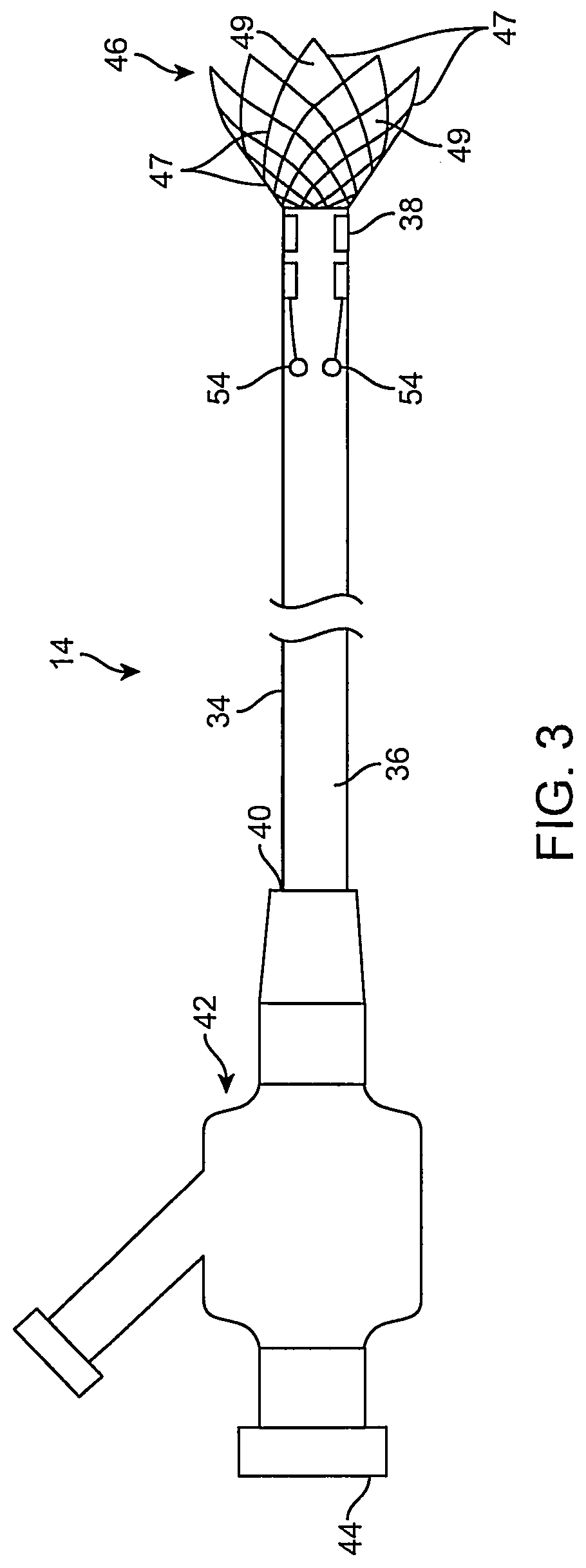 Patent US12096951 Figure 3 – System and method for treating ischemic stroke