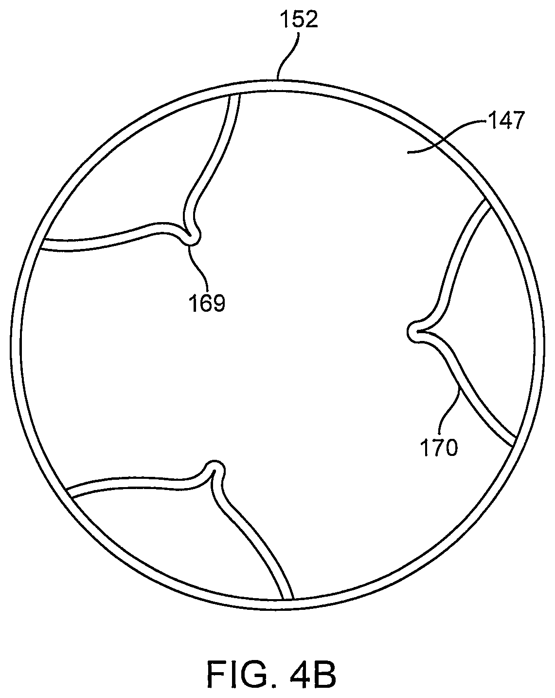 Patent US12096951 Figure 5 – System and method for treating ischemic stroke
