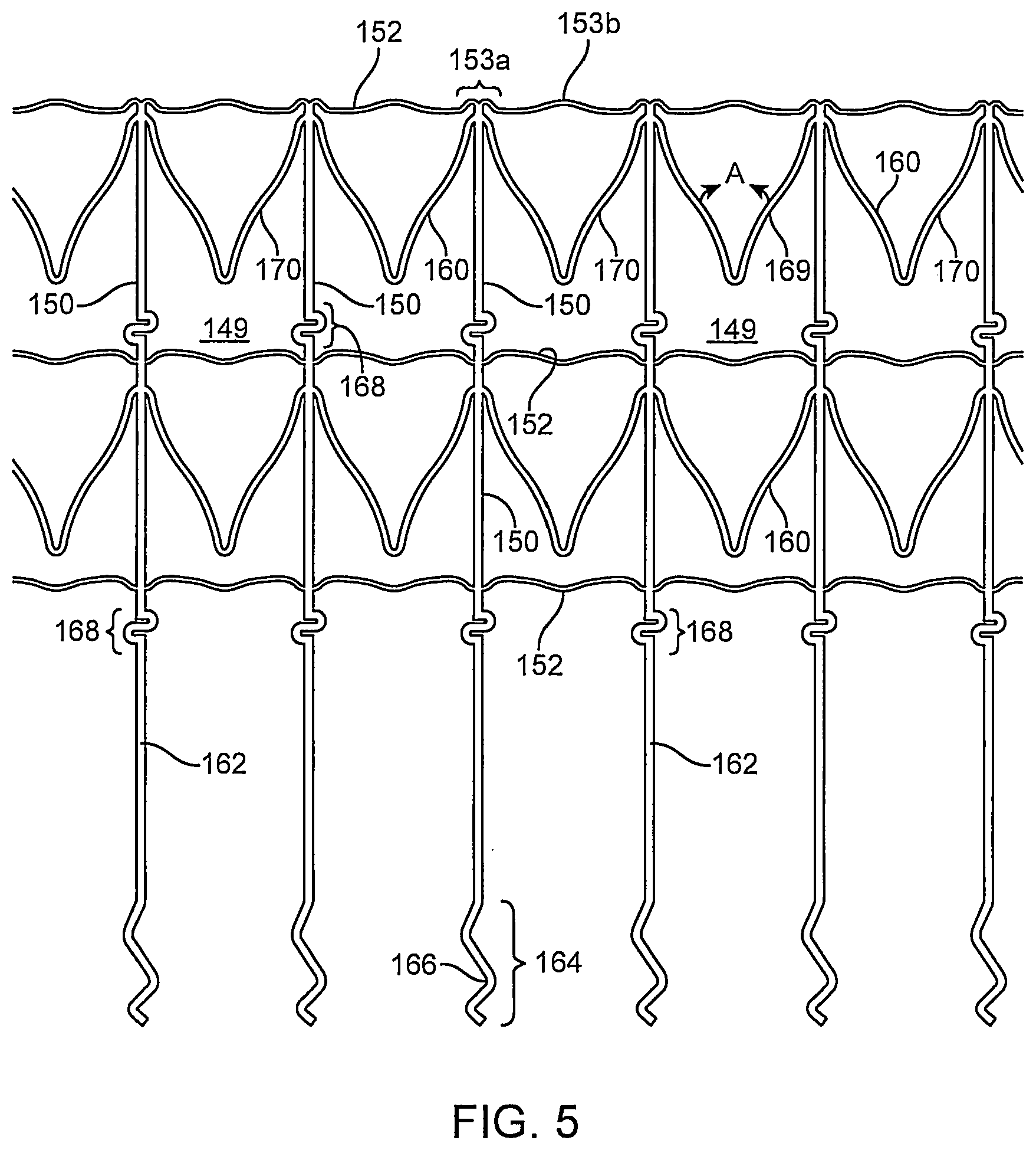 Patent US12096951 Figure 7 – System and method for treating ischemic stroke