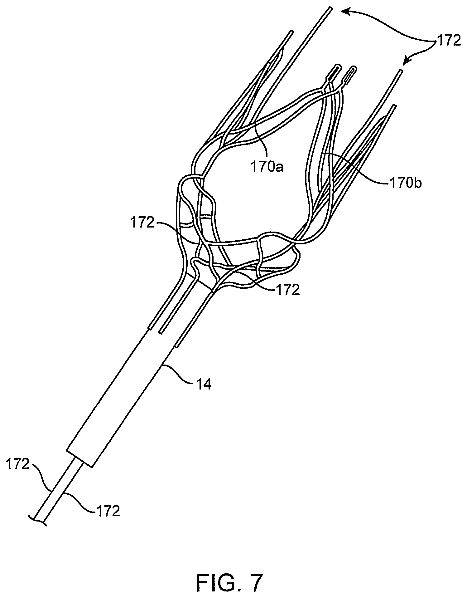 Patent US12096951 Figure 9 – System and method for treating ischemic stroke