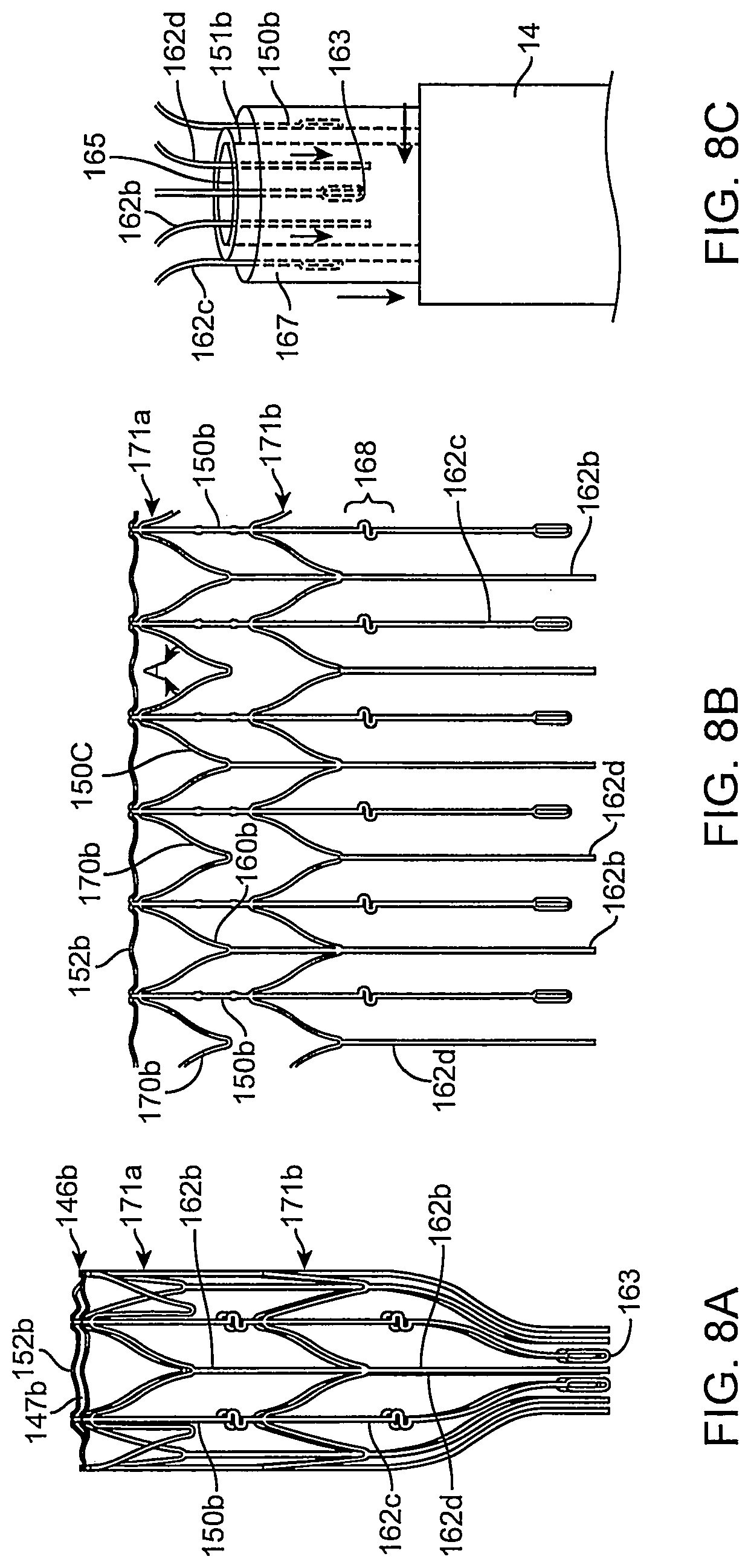 Patent US12096951 Figure 10 – System and method for treating ischemic stroke