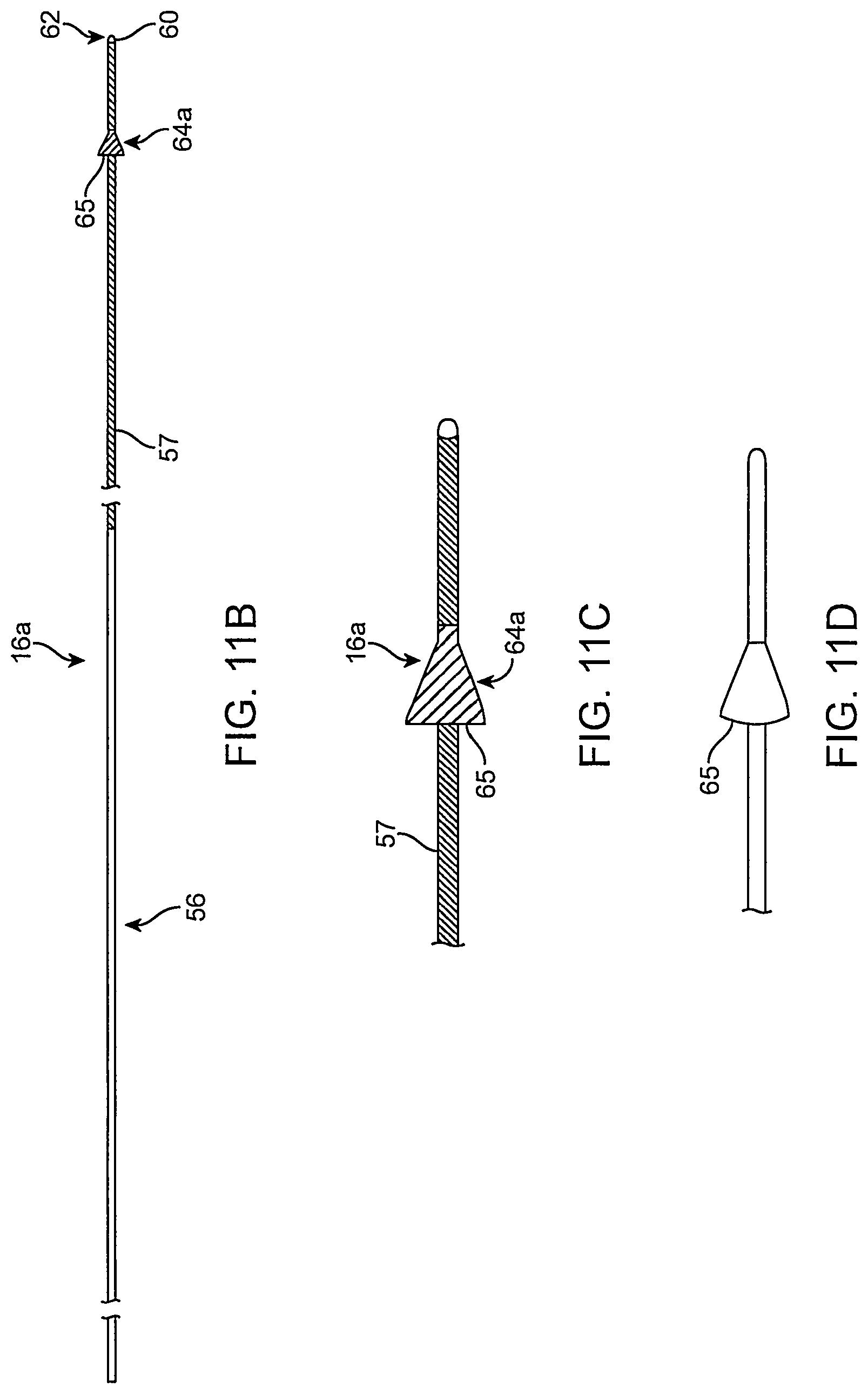 Patent US12096951 Figure 12 – System and method for treating ischemic stroke