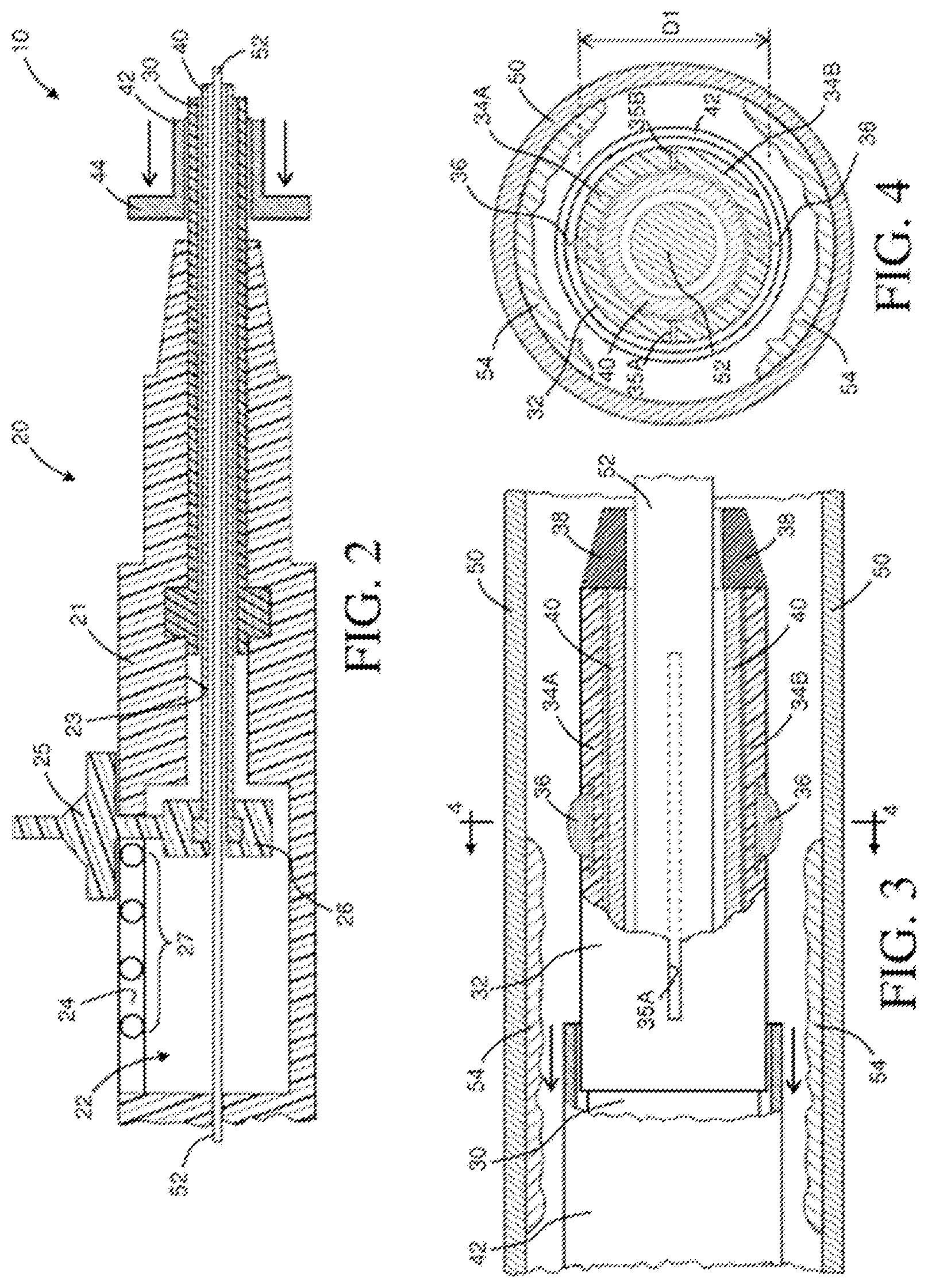 Patent US12096955 Figure 2 – Intravascular catheter having an expandable incising portion and abrasive surfaces