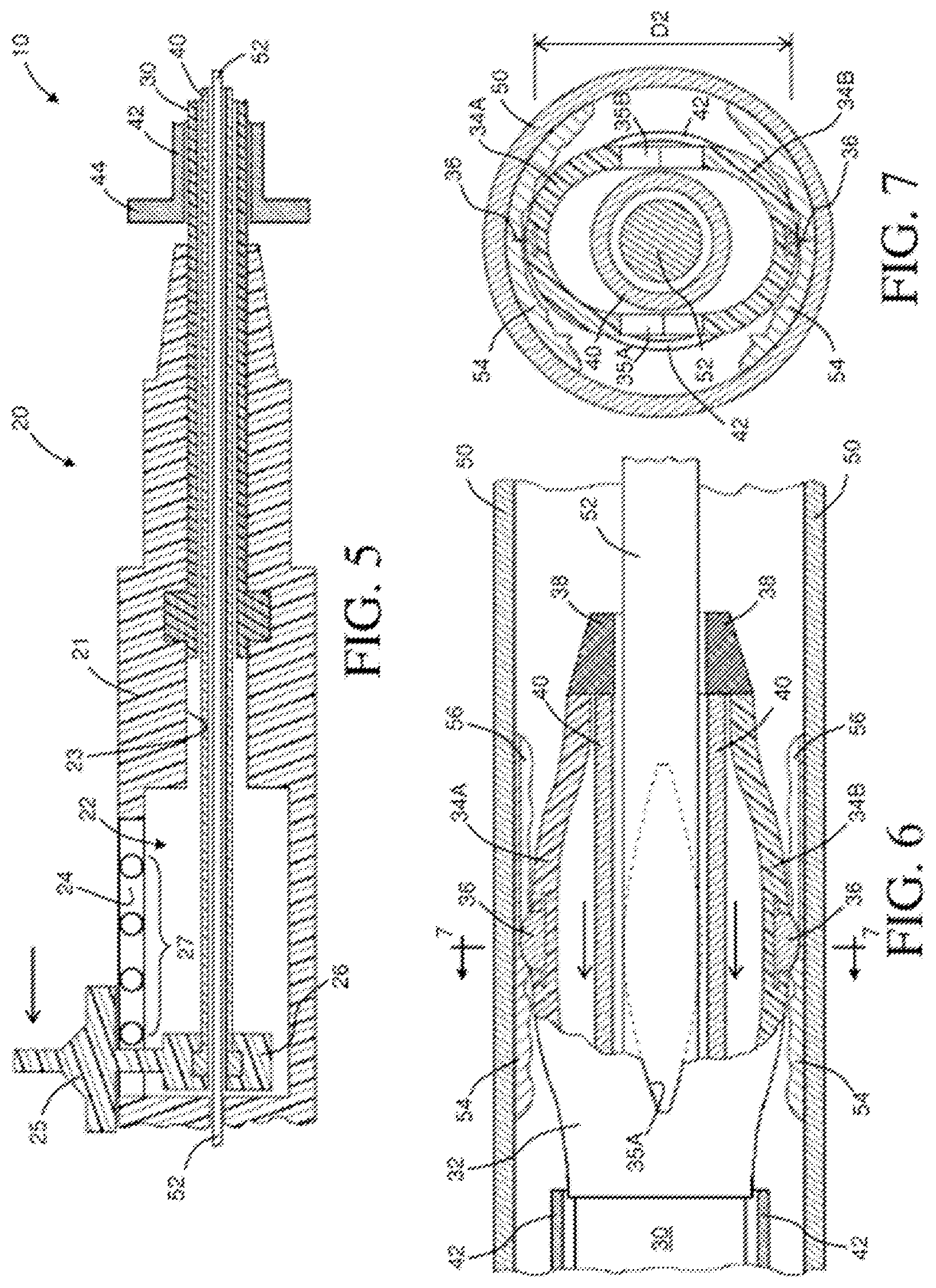 Patent US12096955 Figure 3 – Intravascular catheter having an expandable incising portion and abrasive surfaces
