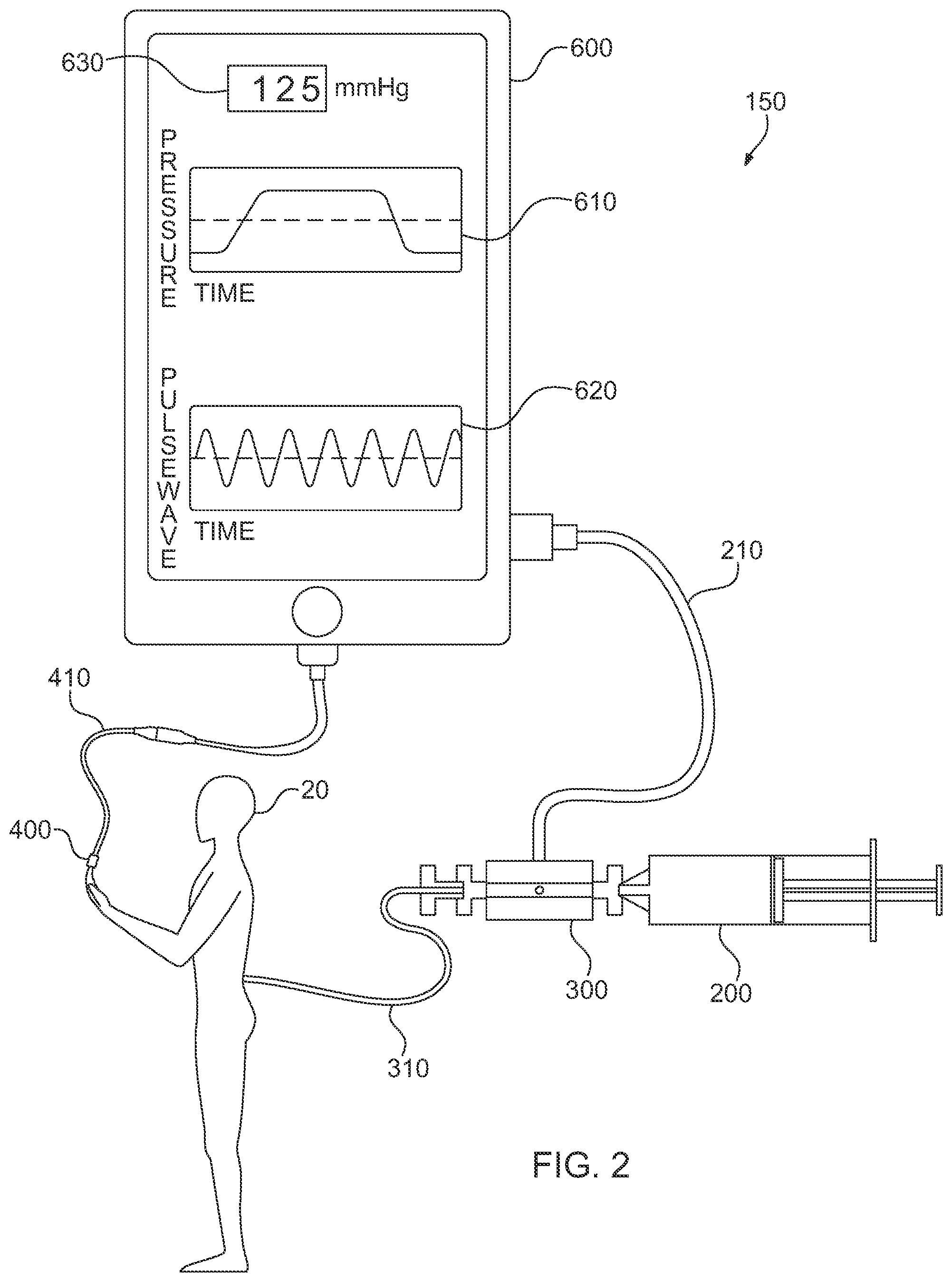 Patent US12096957 Figure 2 – Device and method for needle/catheter location utilizing correlation analysis
