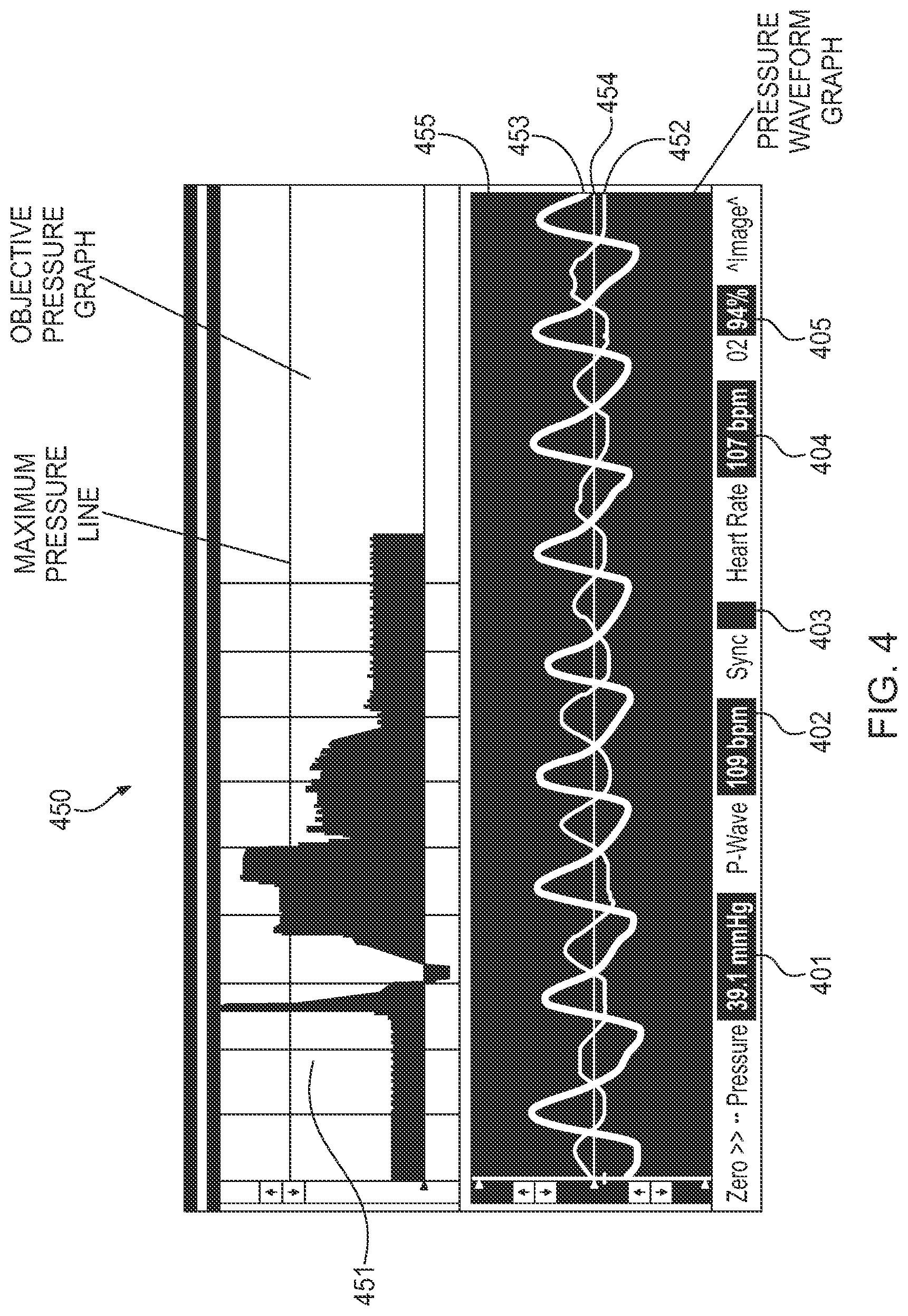 Patent US12096957 Figure 4 – Device and method for needle/catheter location utilizing correlation analysis