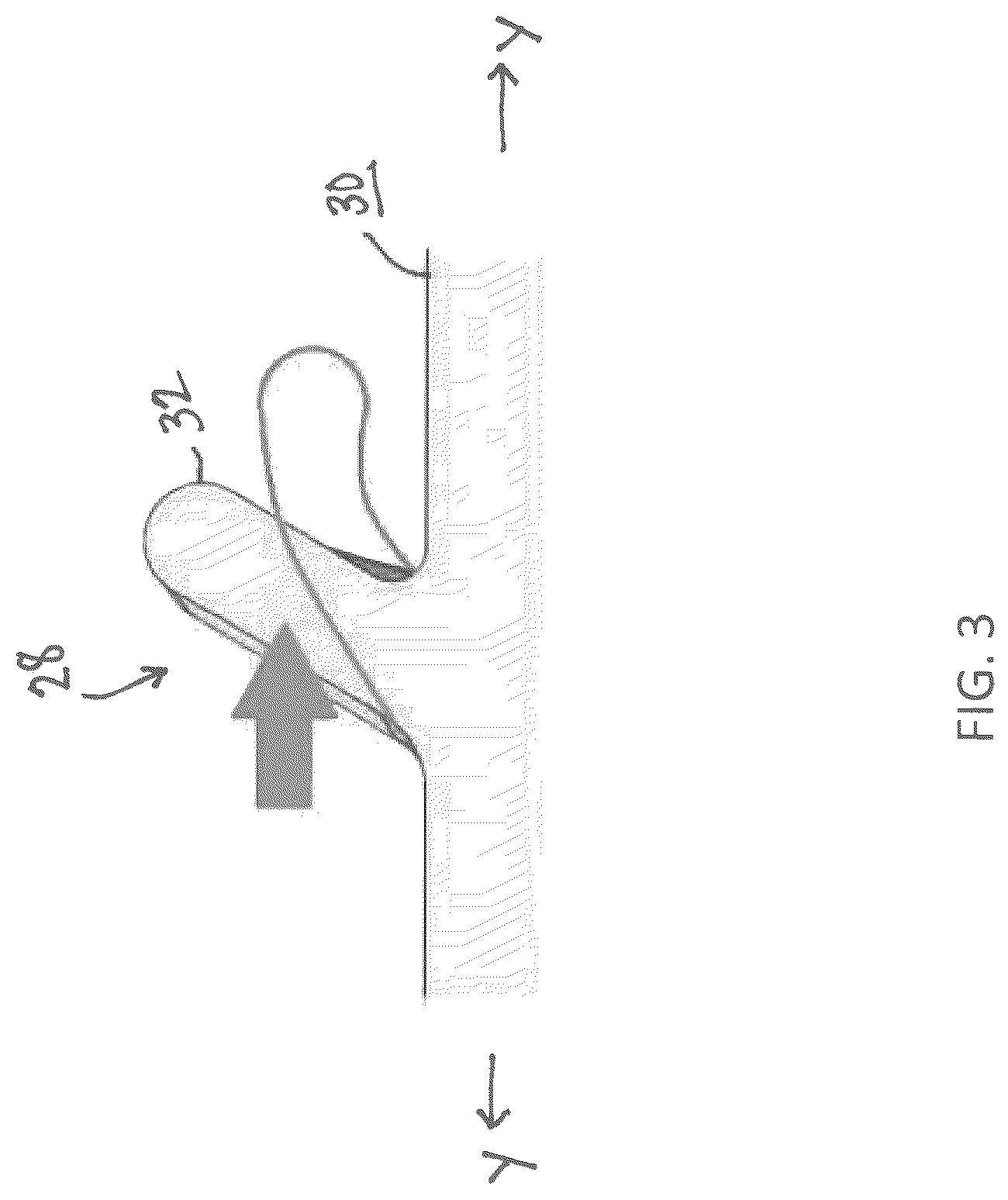 Patent US12096958 Figure 3 – Soft-thread cannula and cannula seal assembly