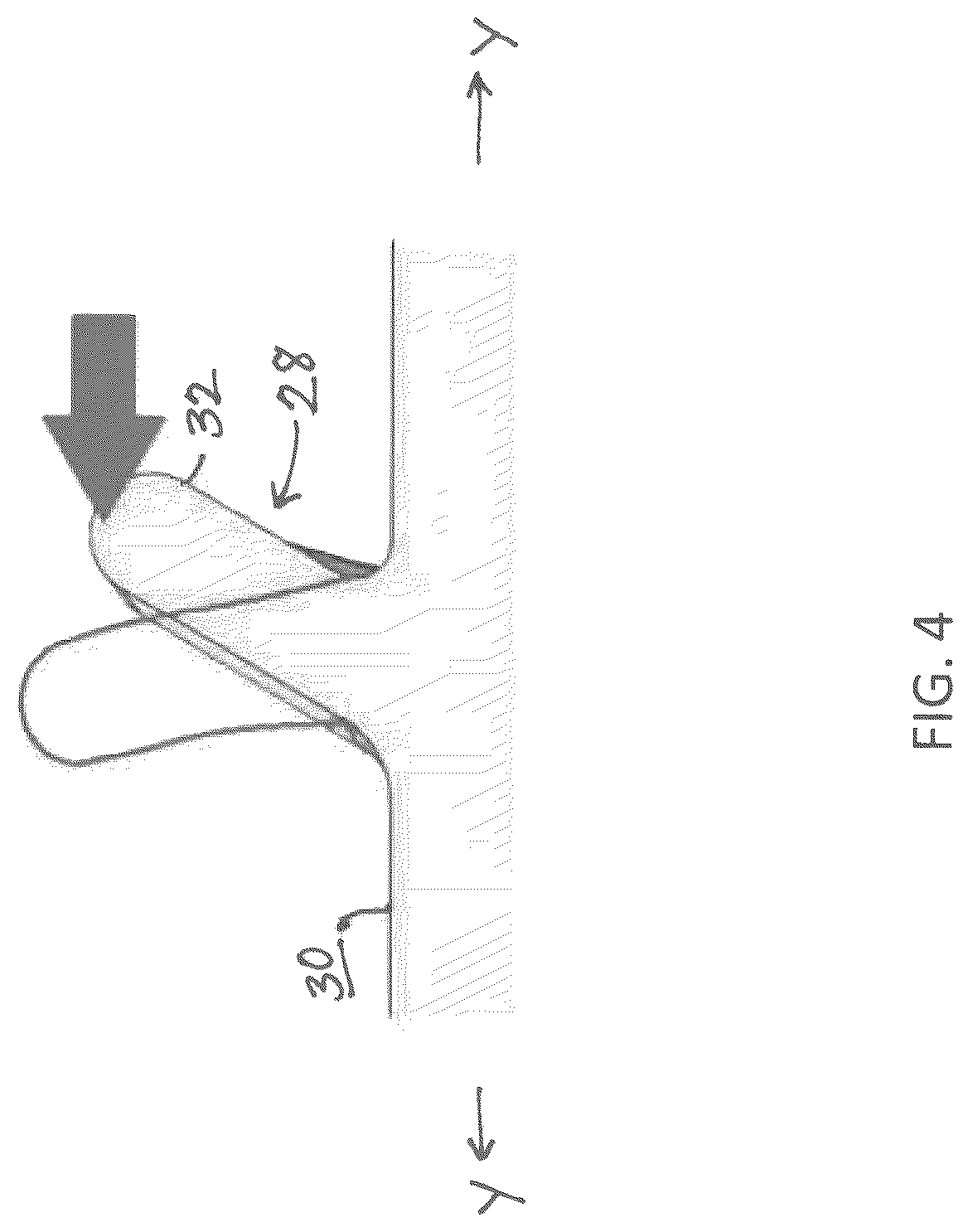 Patent US12096958 Figure 4 – Soft-thread cannula and cannula seal assembly