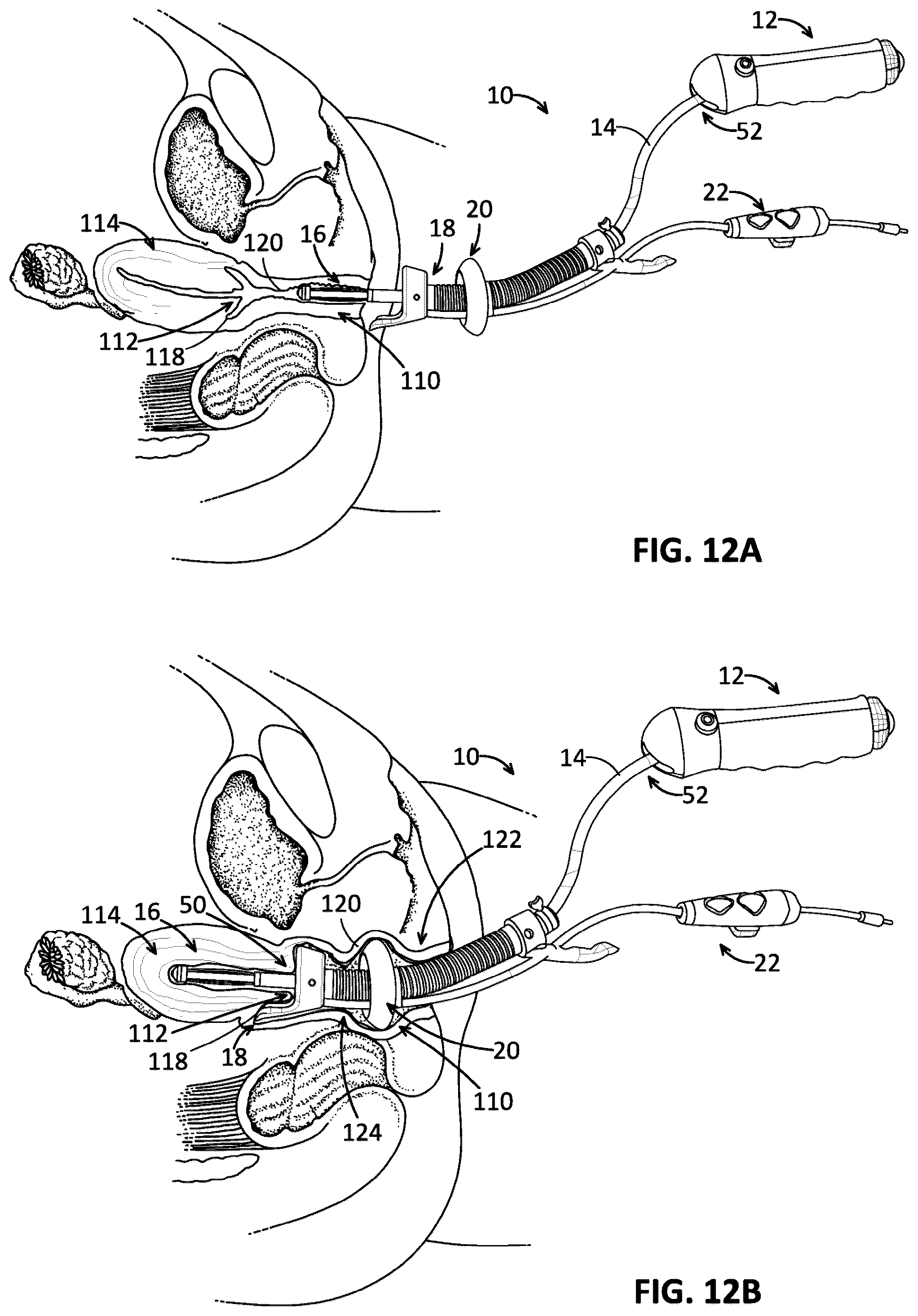 Patent US12096960 Figure 9 – Uterine manipulator