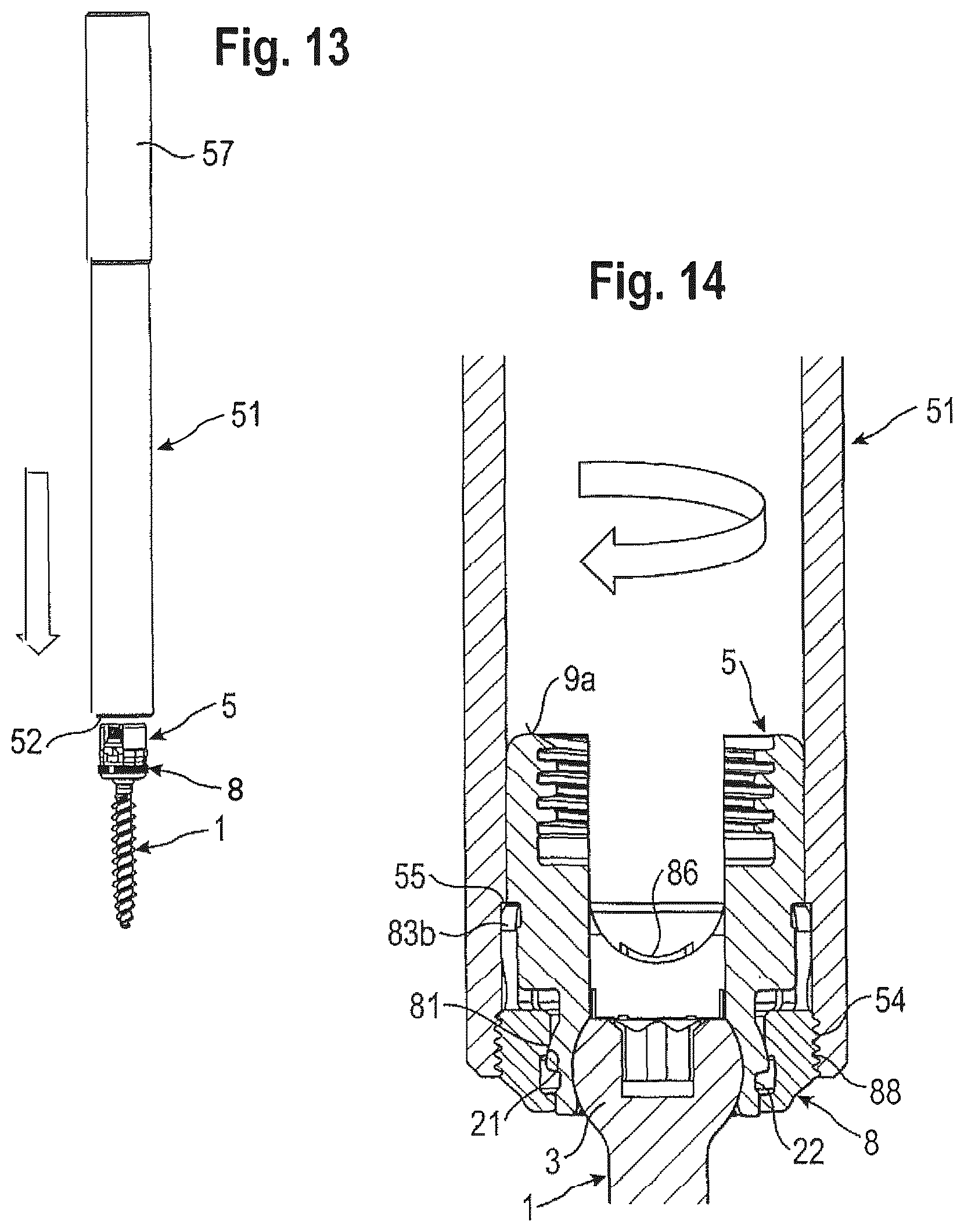Patent US12096962 Figure 5 – Bone anchoring device and tool cooperating with such a bone anchoring device