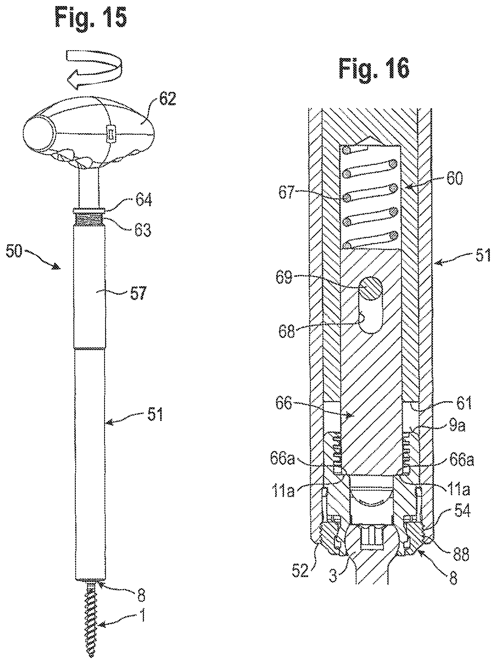 Patent US12096962 Figure 6 – Bone anchoring device and tool cooperating with such a bone anchoring device