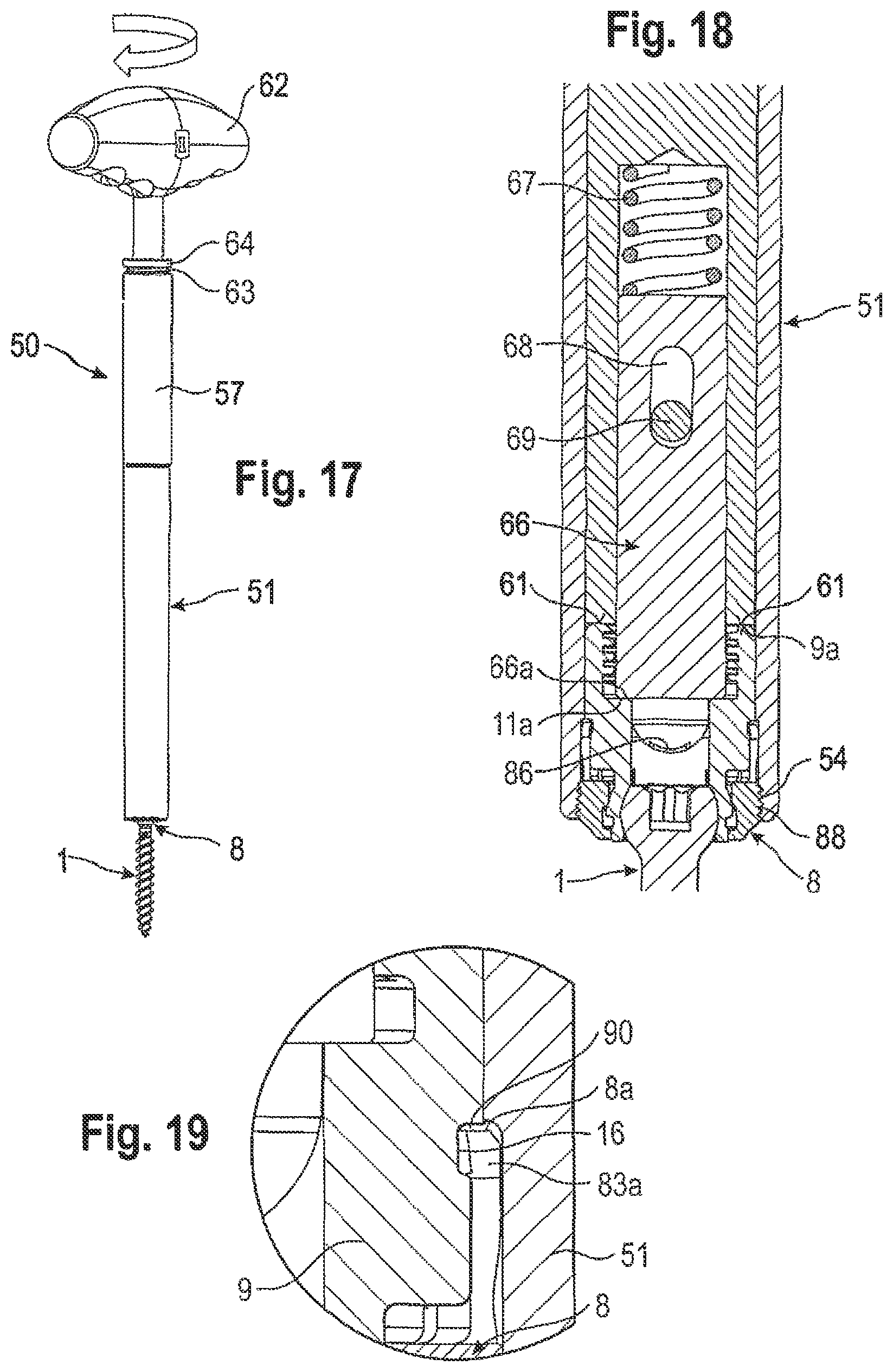 Patent US12096962 Figure 7 – Bone anchoring device and tool cooperating with such a bone anchoring device