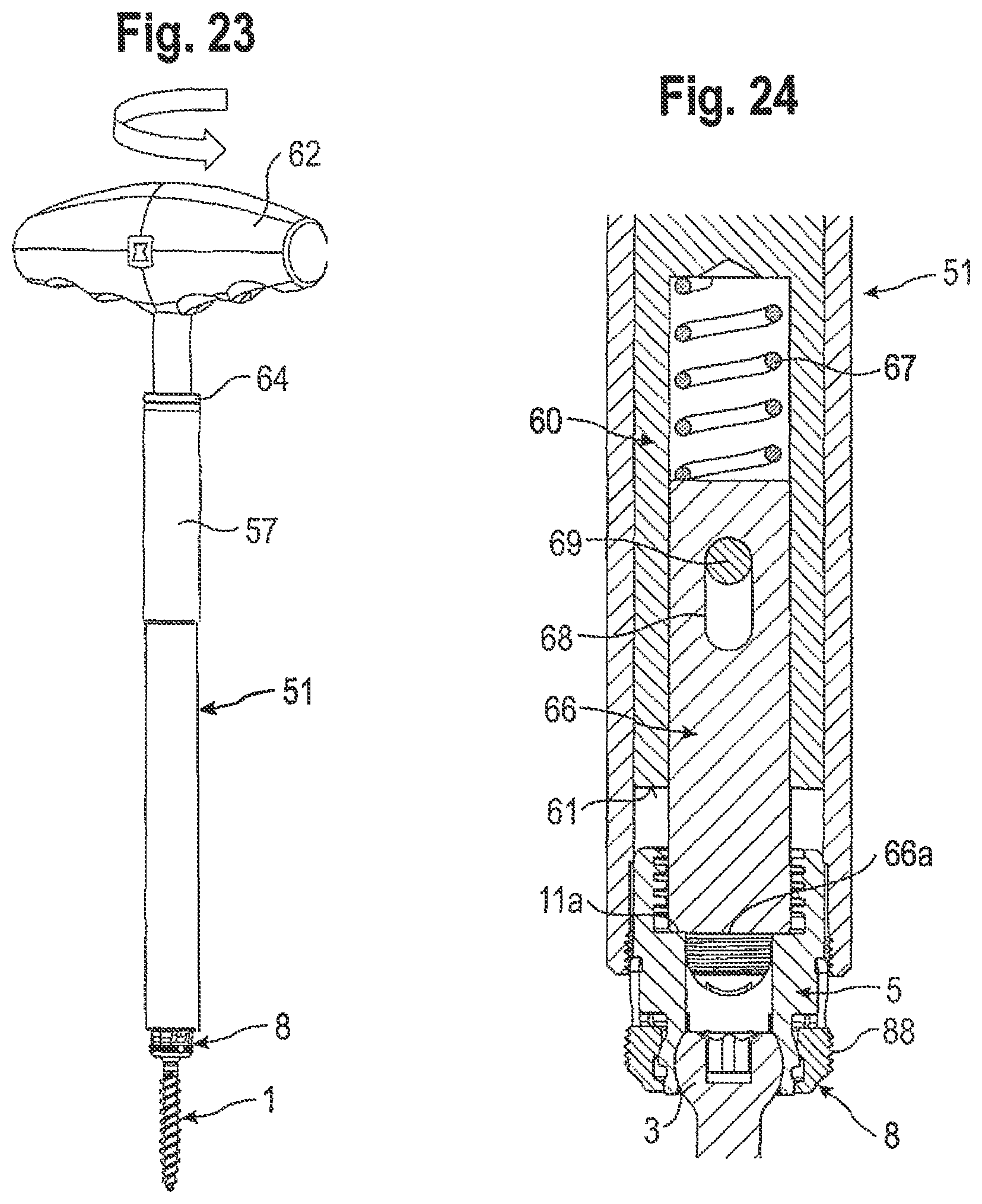 Patent US12096962 Figure 9 – Bone anchoring device and tool cooperating with such a bone anchoring device