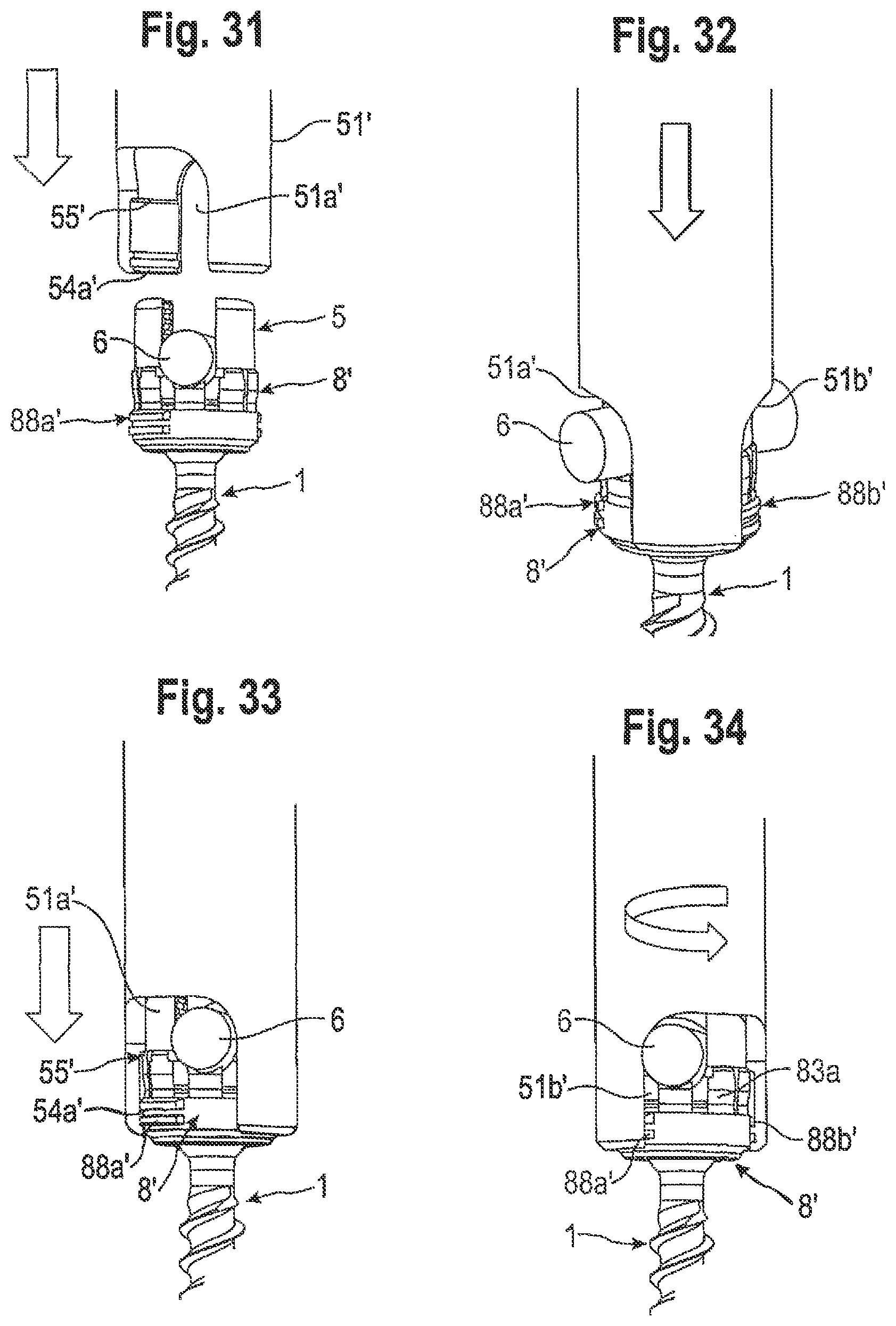 Patent US12096962 Figure 12 – Bone anchoring device and tool cooperating with such a bone anchoring device