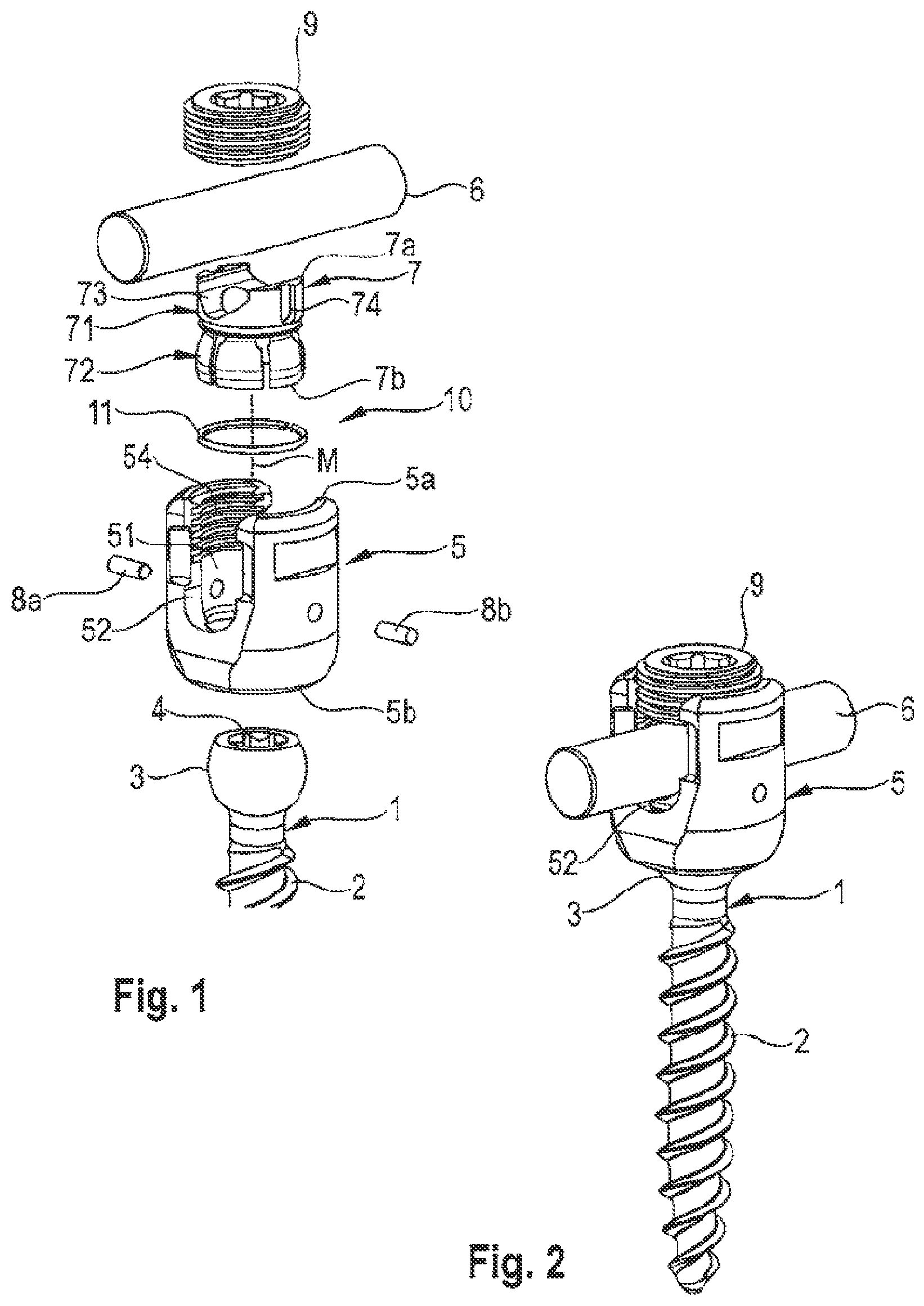 Patent US12096963 Figure 1 – Coupling assembly for coupling a rod to a bone anchoring element and bone anchoring device with such a coupling assembly
