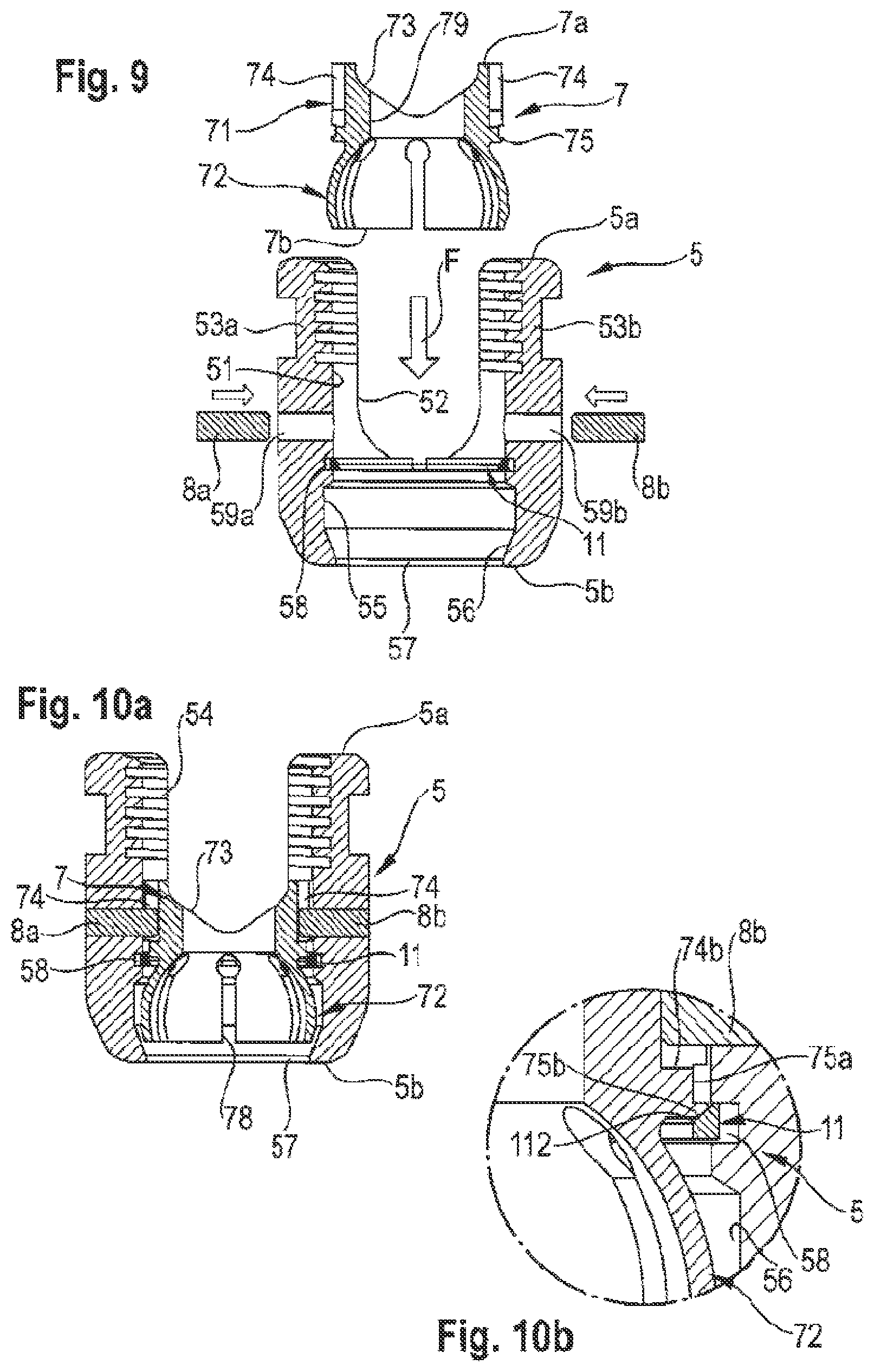 Patent US12096963 Figure 3 – Coupling assembly for coupling a rod to a bone anchoring element and bone anchoring device with such a coupling assembly