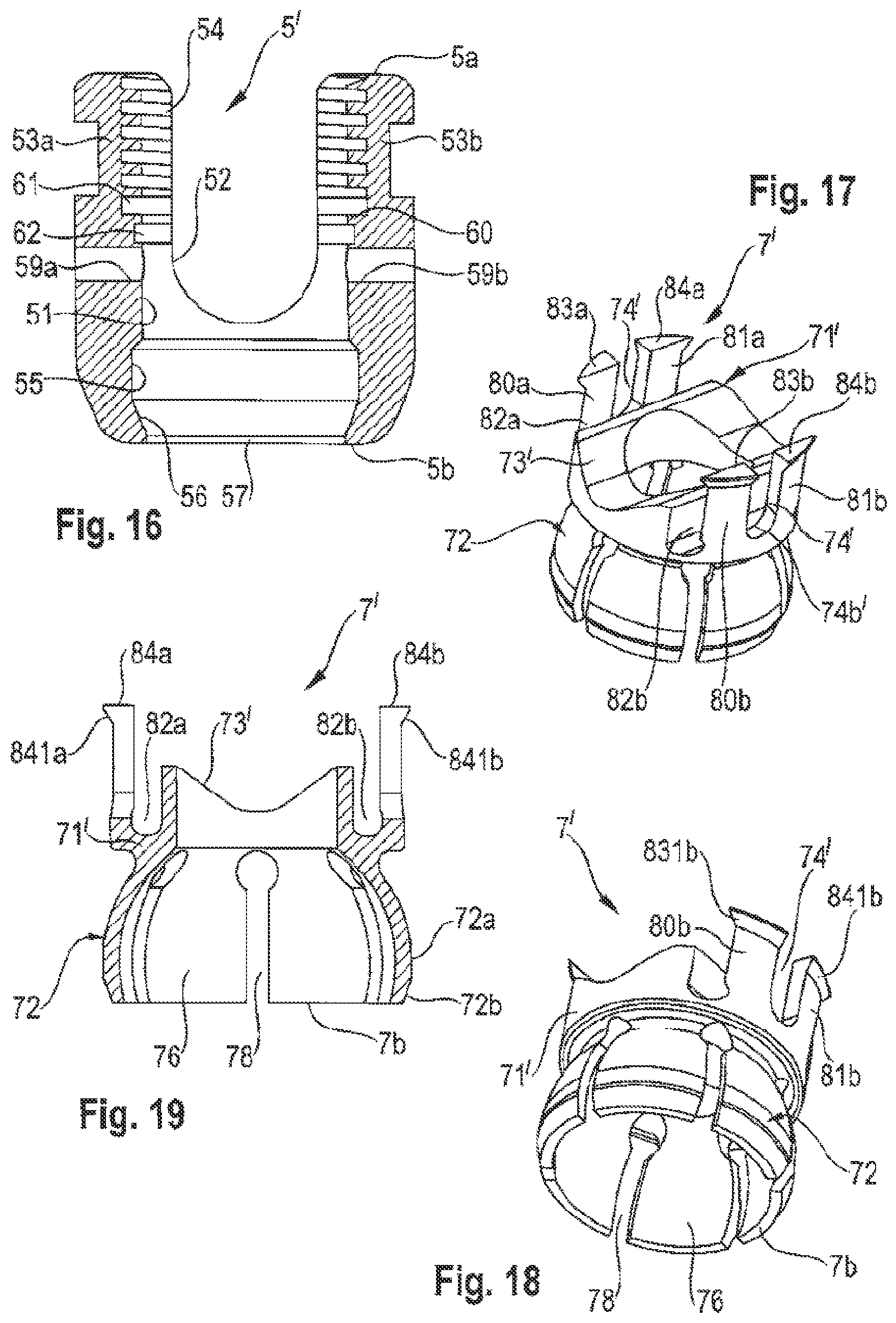 Patent US12096963 Figure 6 – Coupling assembly for coupling a rod to a bone anchoring element and bone anchoring device with such a coupling assembly
