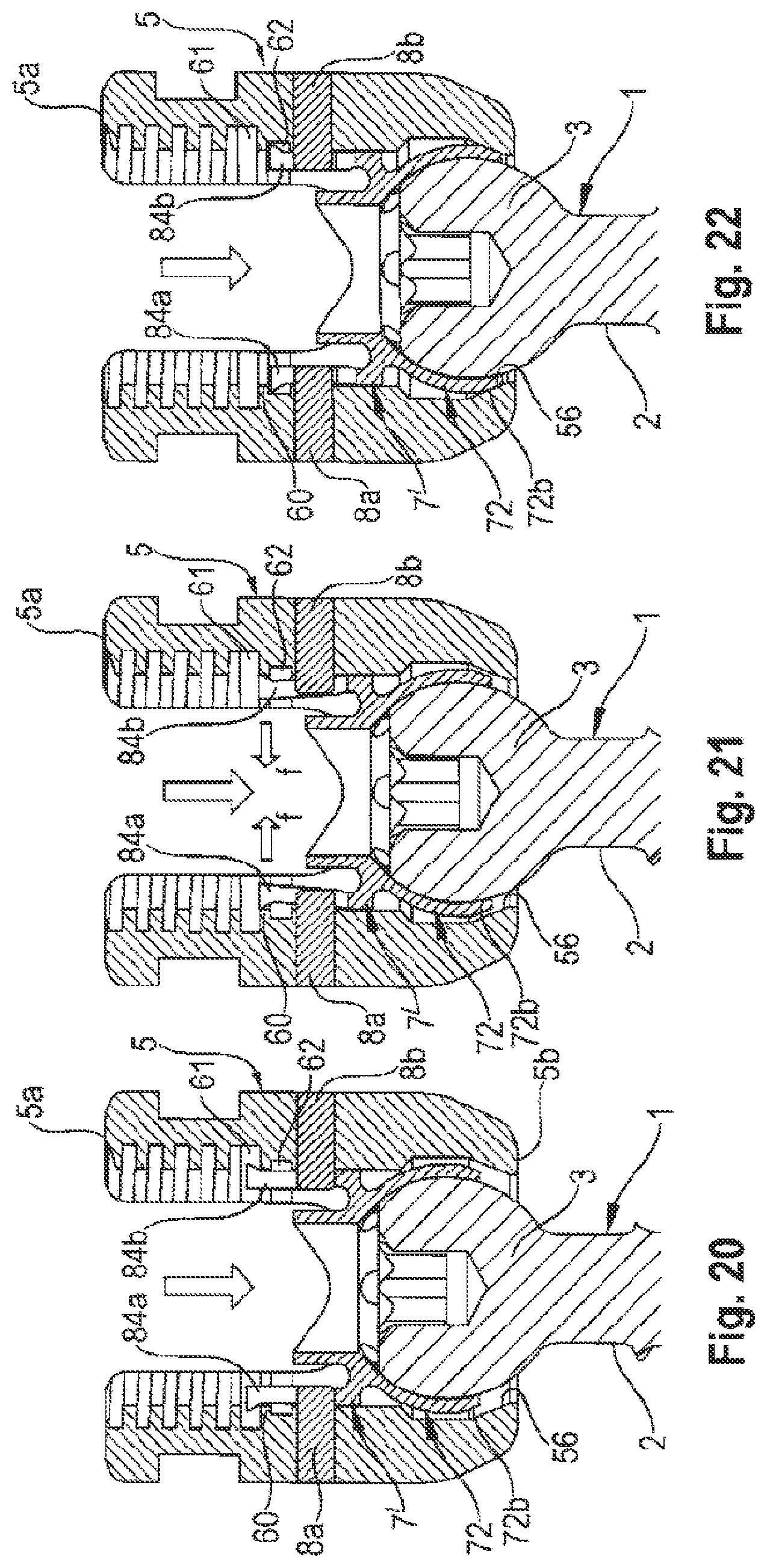 Patent US12096963 Figure 7 – Coupling assembly for coupling a rod to a bone anchoring element and bone anchoring device with such a coupling assembly