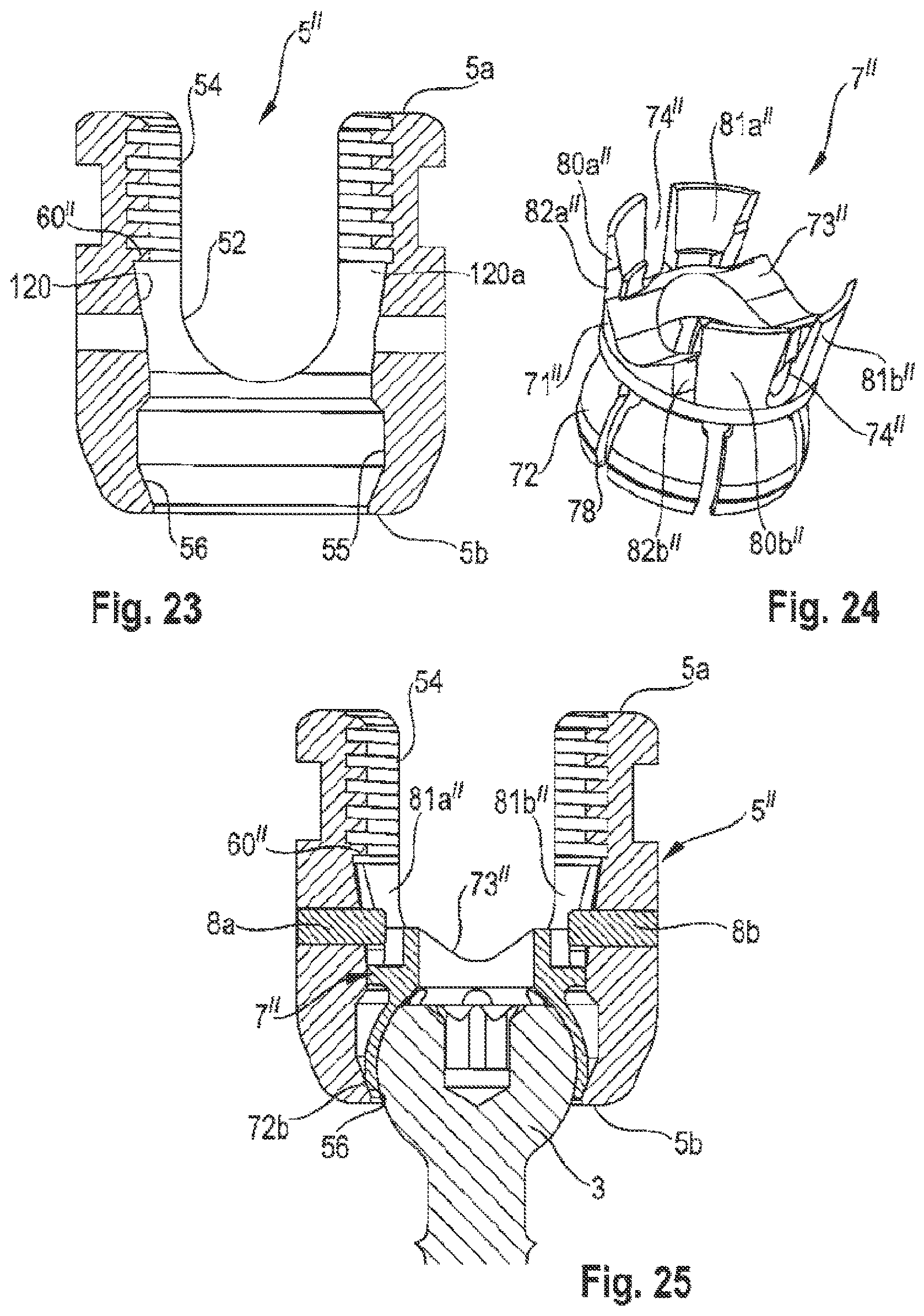 Patent US12096963 Figure 8 – Coupling assembly for coupling a rod to a bone anchoring element and bone anchoring device with such a coupling assembly