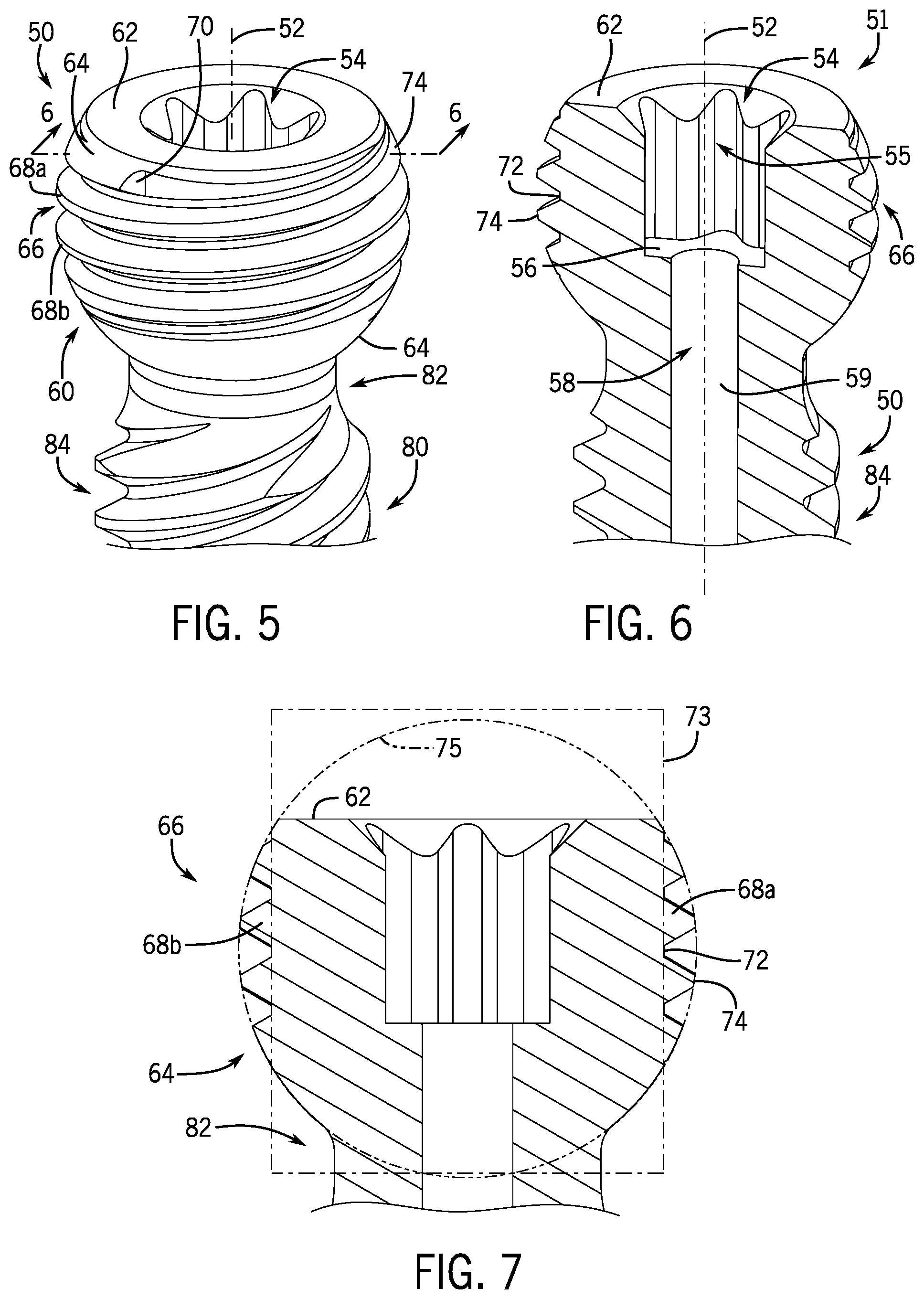 Patent US12096964 Figure 4 – Modular bone anchor system with bottom loaded shank heads having a single shank head shape