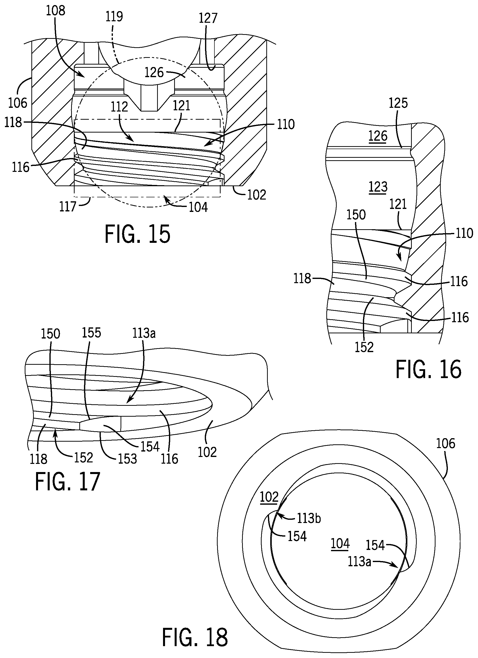 Patent US12096964 Figure 6 – Modular bone anchor system with bottom loaded shank heads having a single shank head shape