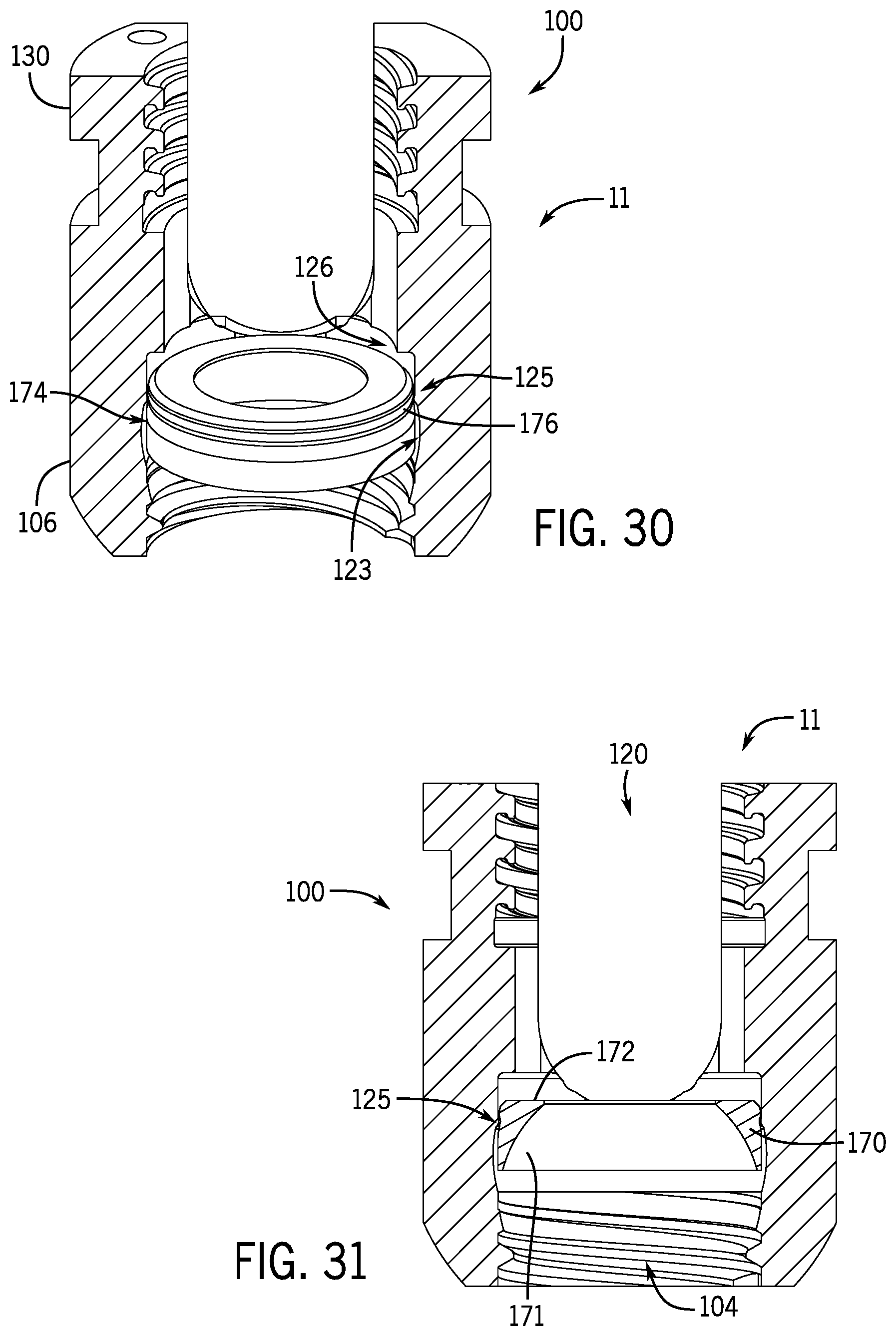 Patent US12096964 Figure 10 – Modular bone anchor system with bottom loaded shank heads having a single shank head shape