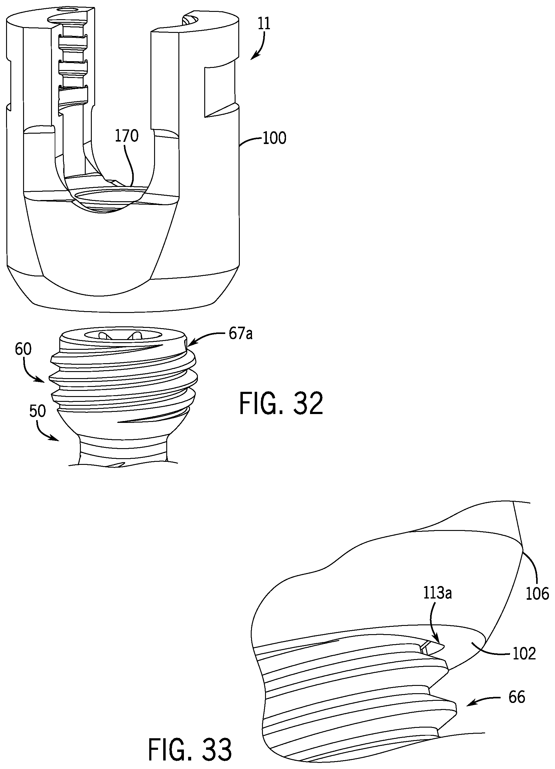 Patent US12096964 Figure 11 – Modular bone anchor system with bottom loaded shank heads having a single shank head shape