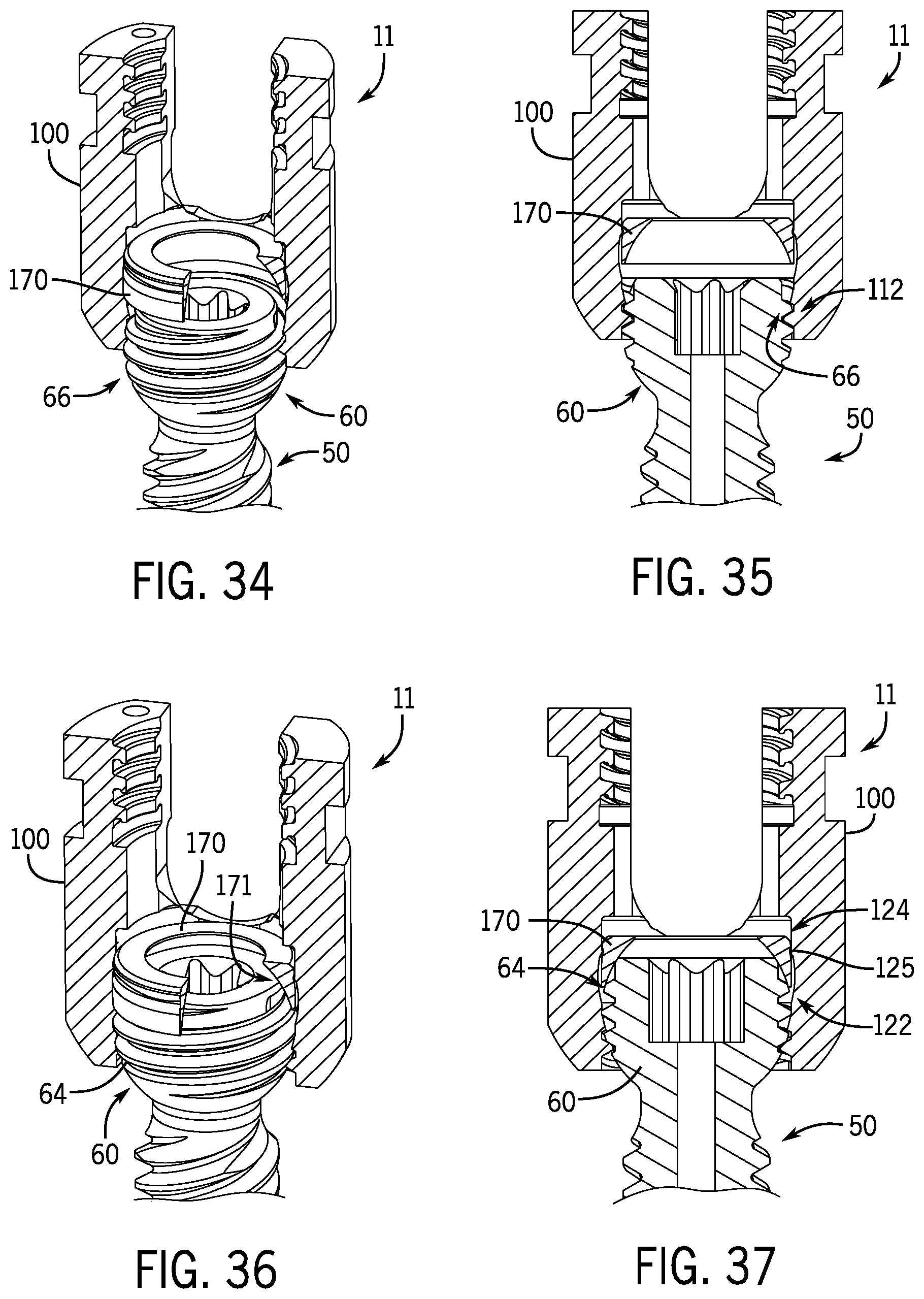 Patent US12096964 Figure 12 – Modular bone anchor system with bottom loaded shank heads having a single shank head shape