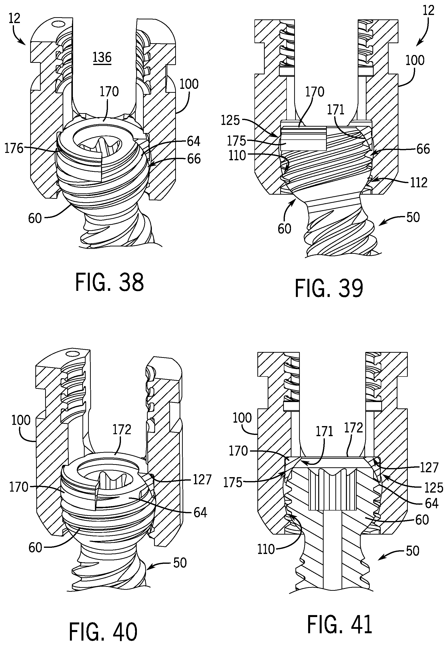 Patent US12096964 Figure 13 – Modular bone anchor system with bottom loaded shank heads having a single shank head shape