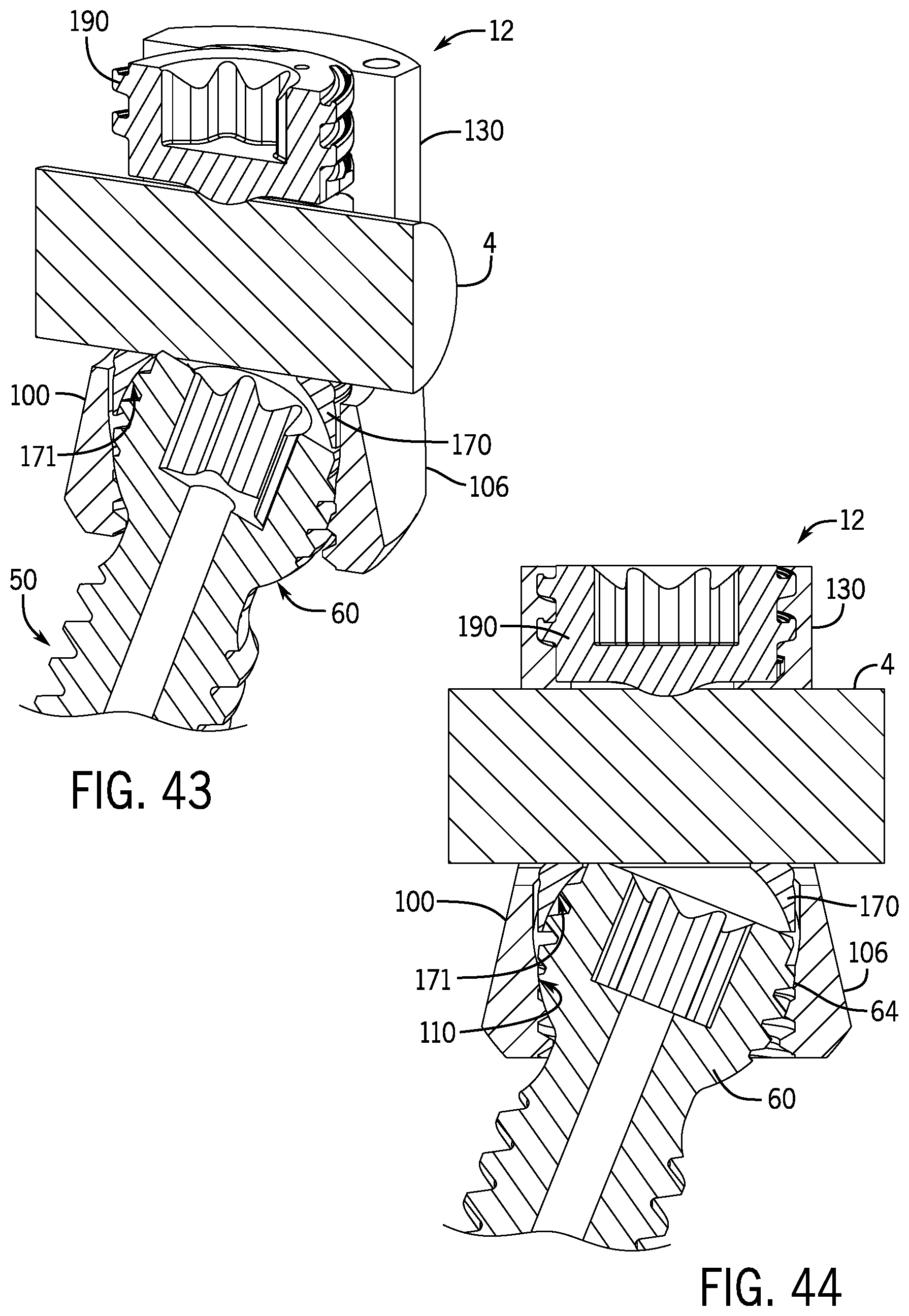 Patent US12096964 Figure 15 – Modular bone anchor system with bottom loaded shank heads having a single shank head shape