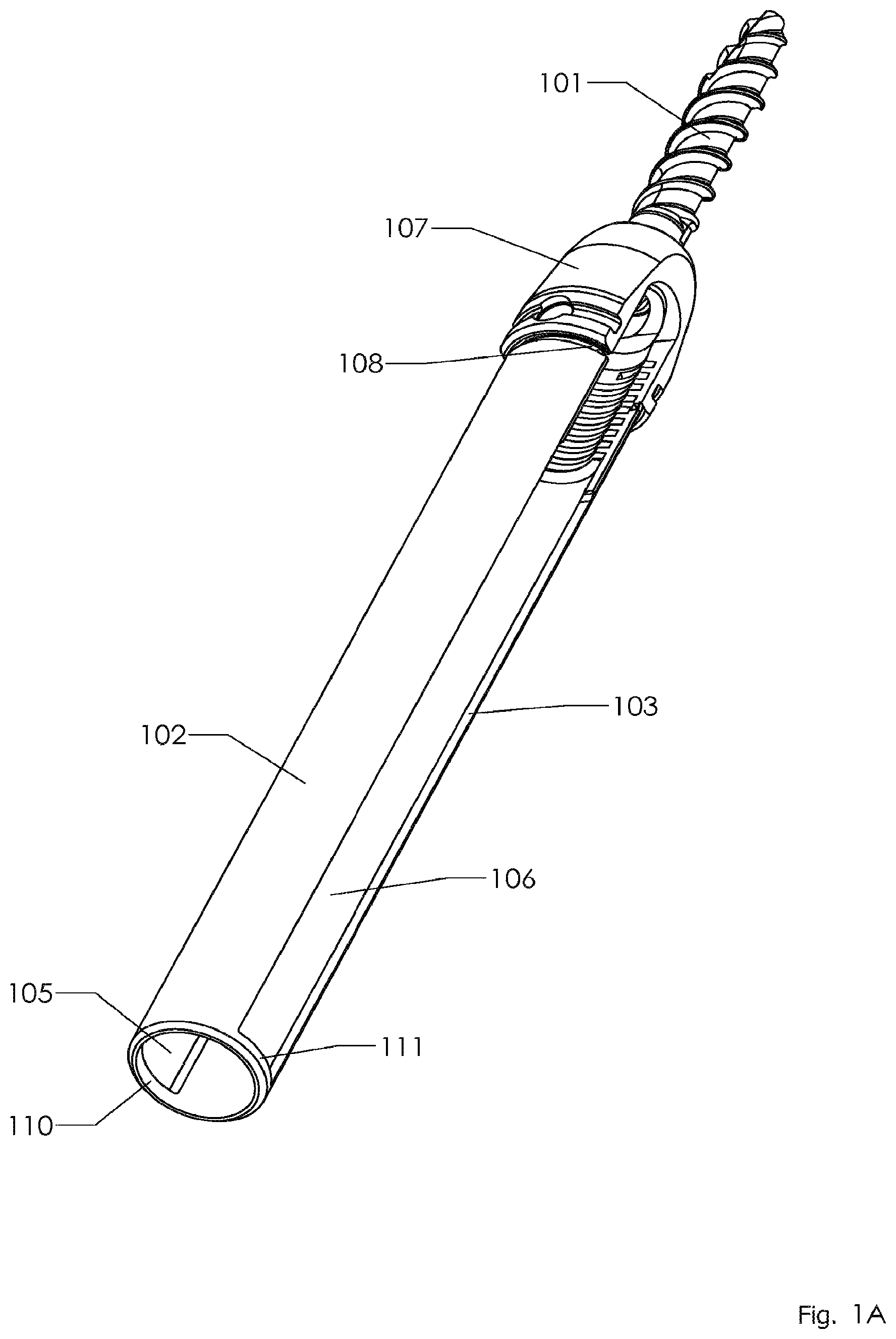 Patent US12096965 Figure 1 – Minimally invasive pedicle screw extension sleeve system