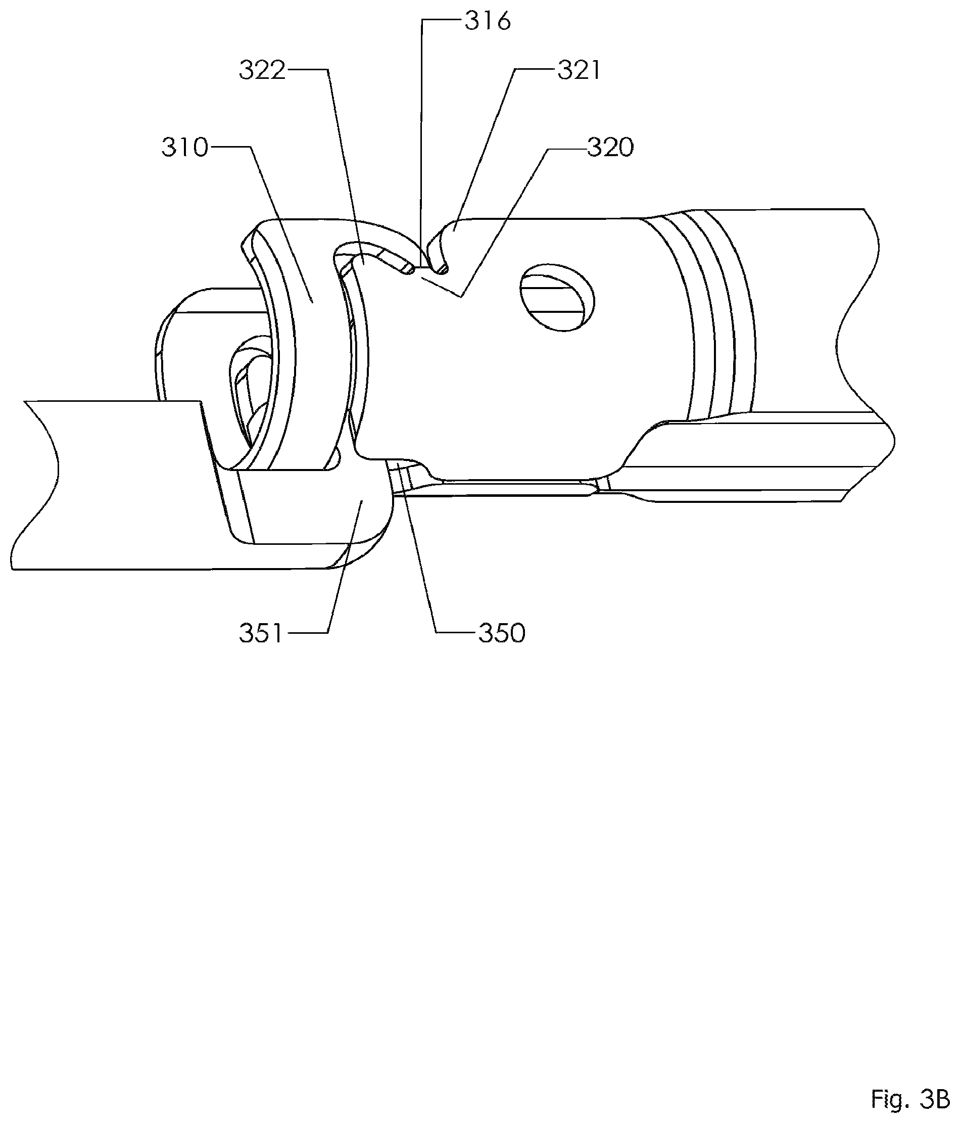 Patent US12096965 Figure 17 – Minimally invasive pedicle screw extension sleeve system
