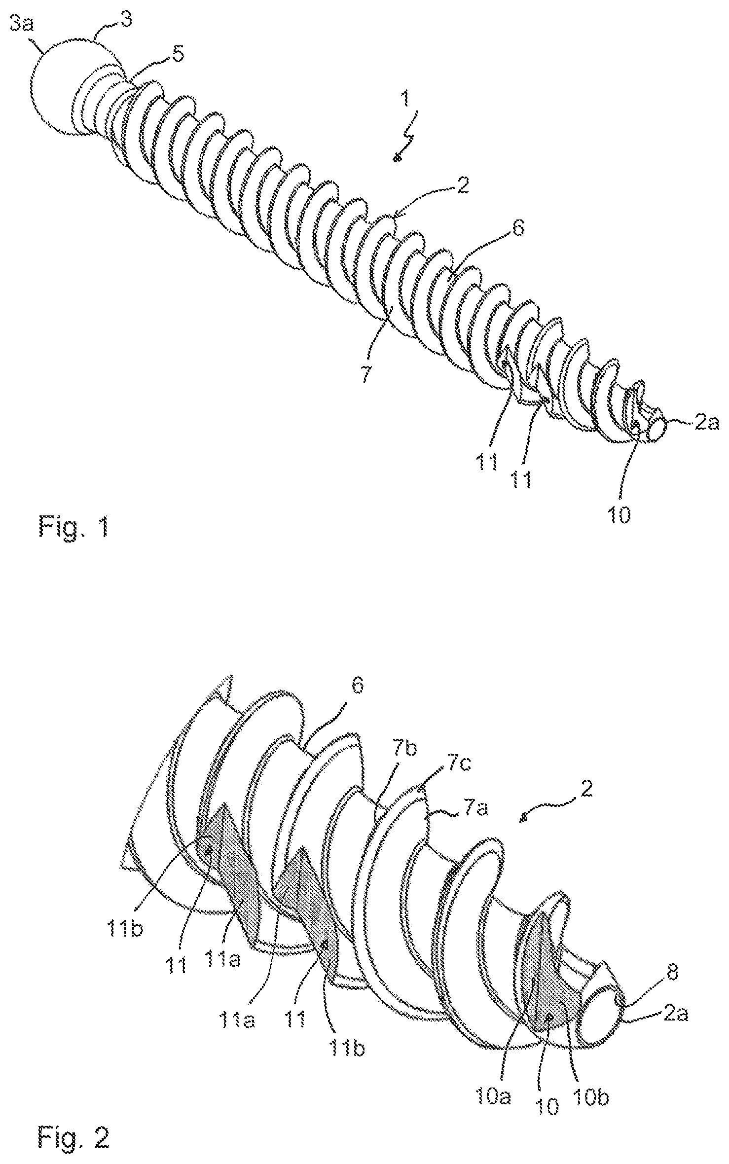 Patent US12096966 Figure 1 – Bone anchor