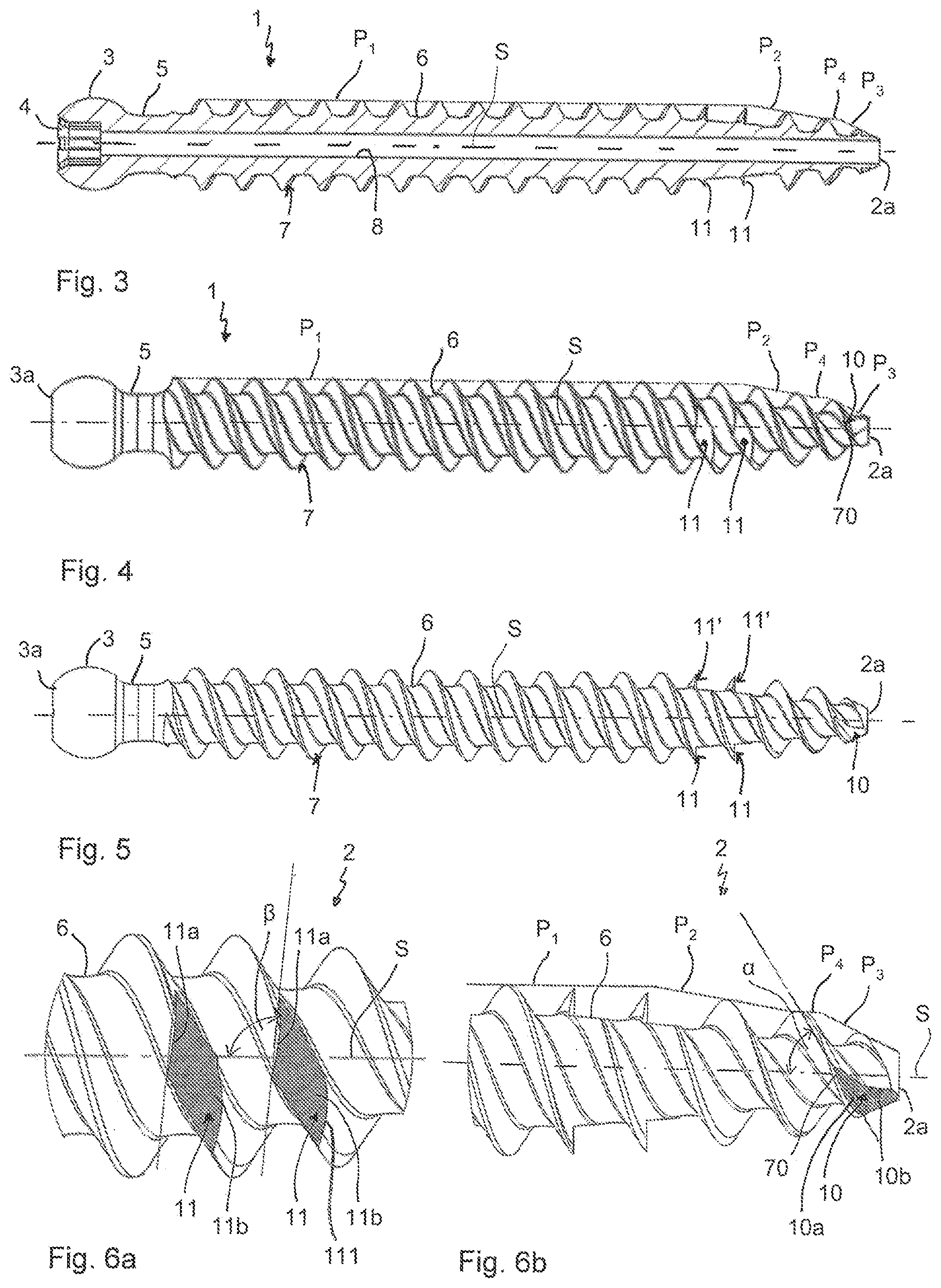 Patent US12096966 Figure 2 – Bone anchor