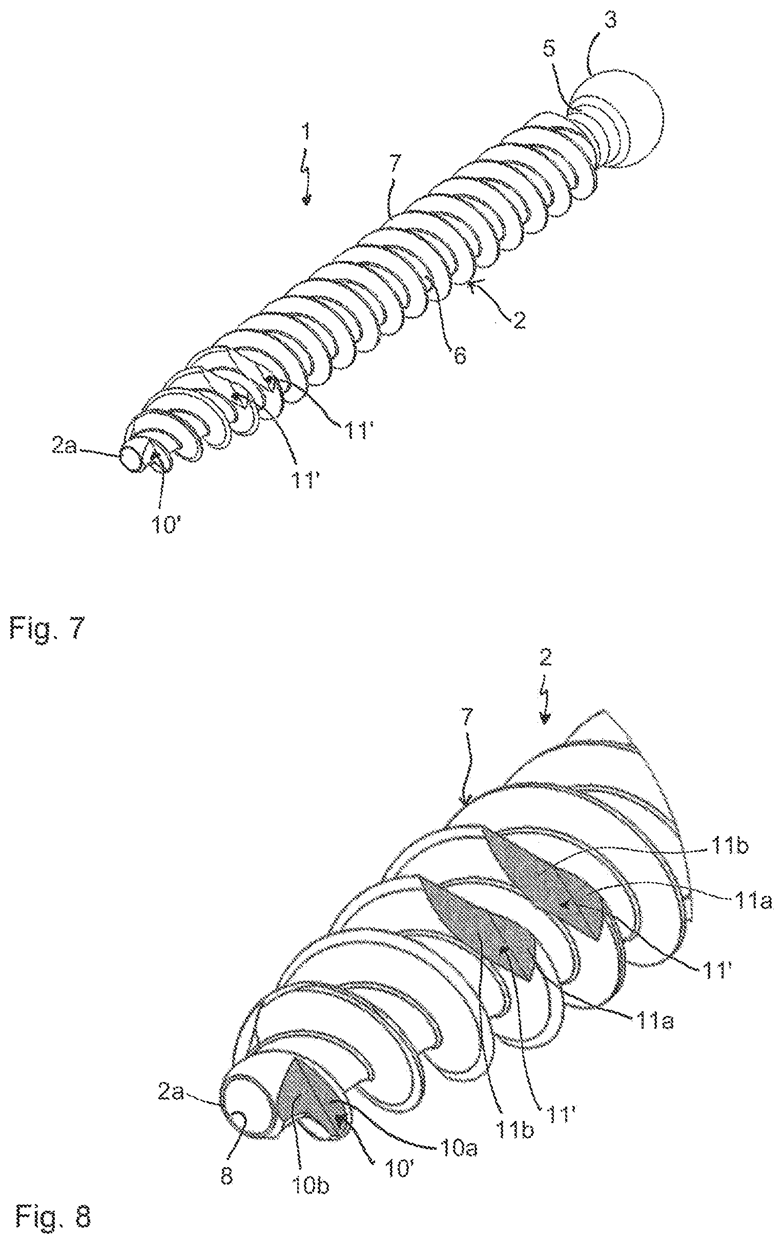 Patent US12096966 Figure 3 – Bone anchor