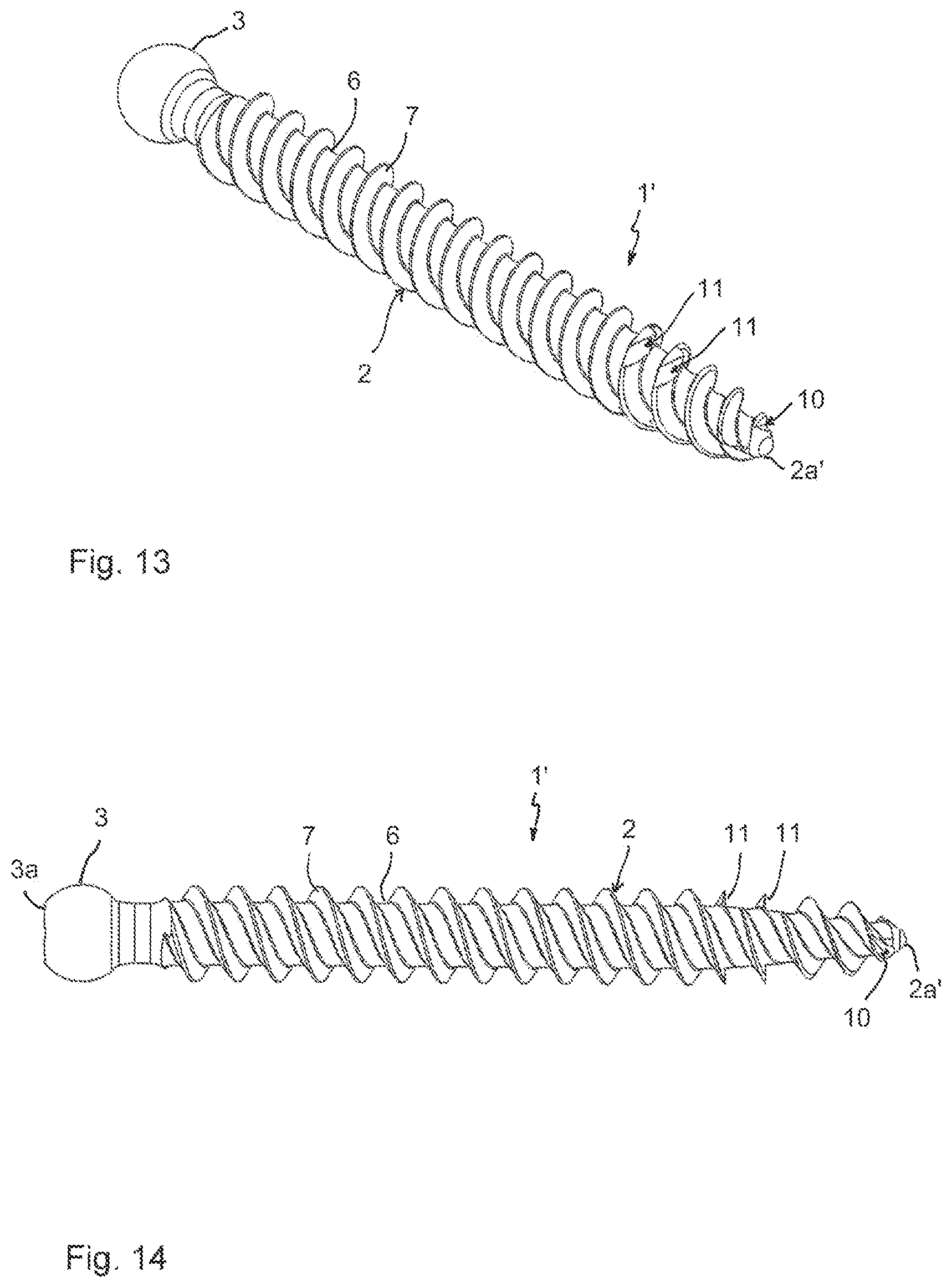 Patent US12096966 Figure 6 – Bone anchor