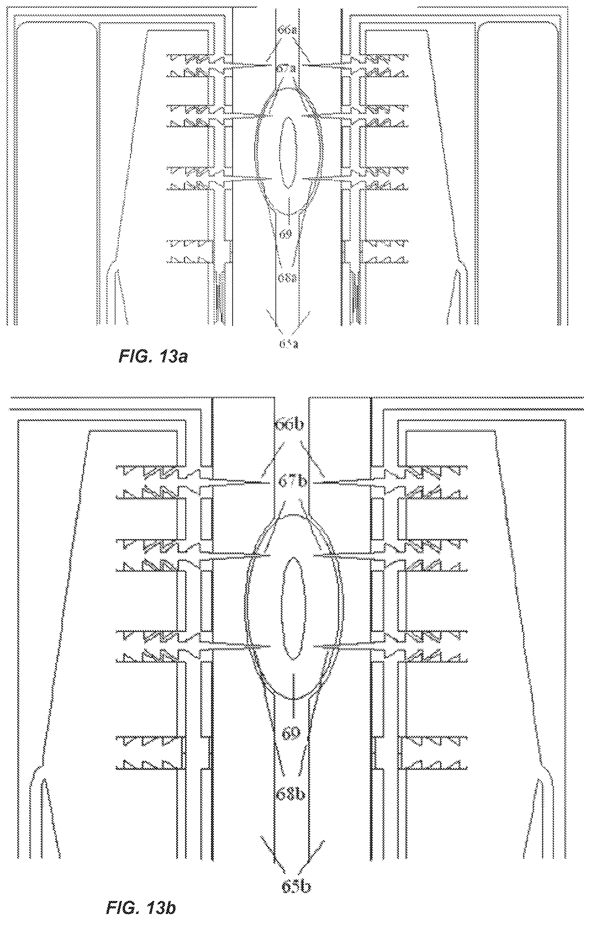 Patent US12096968 Figure 7 – Chemical ablation apparatus for treating arrhythmia