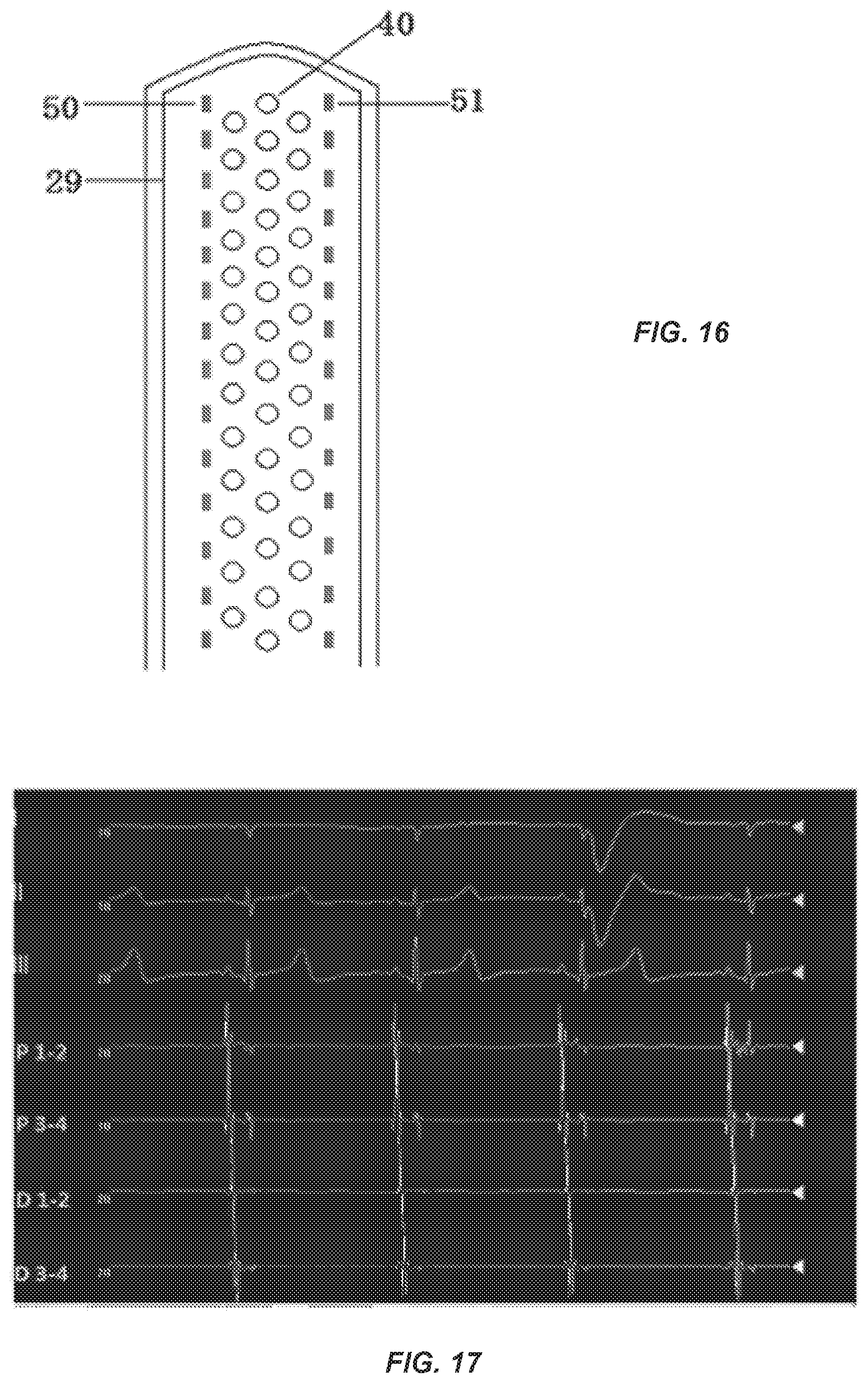 Patent US12096968 Figure 9 – Chemical ablation apparatus for treating arrhythmia
