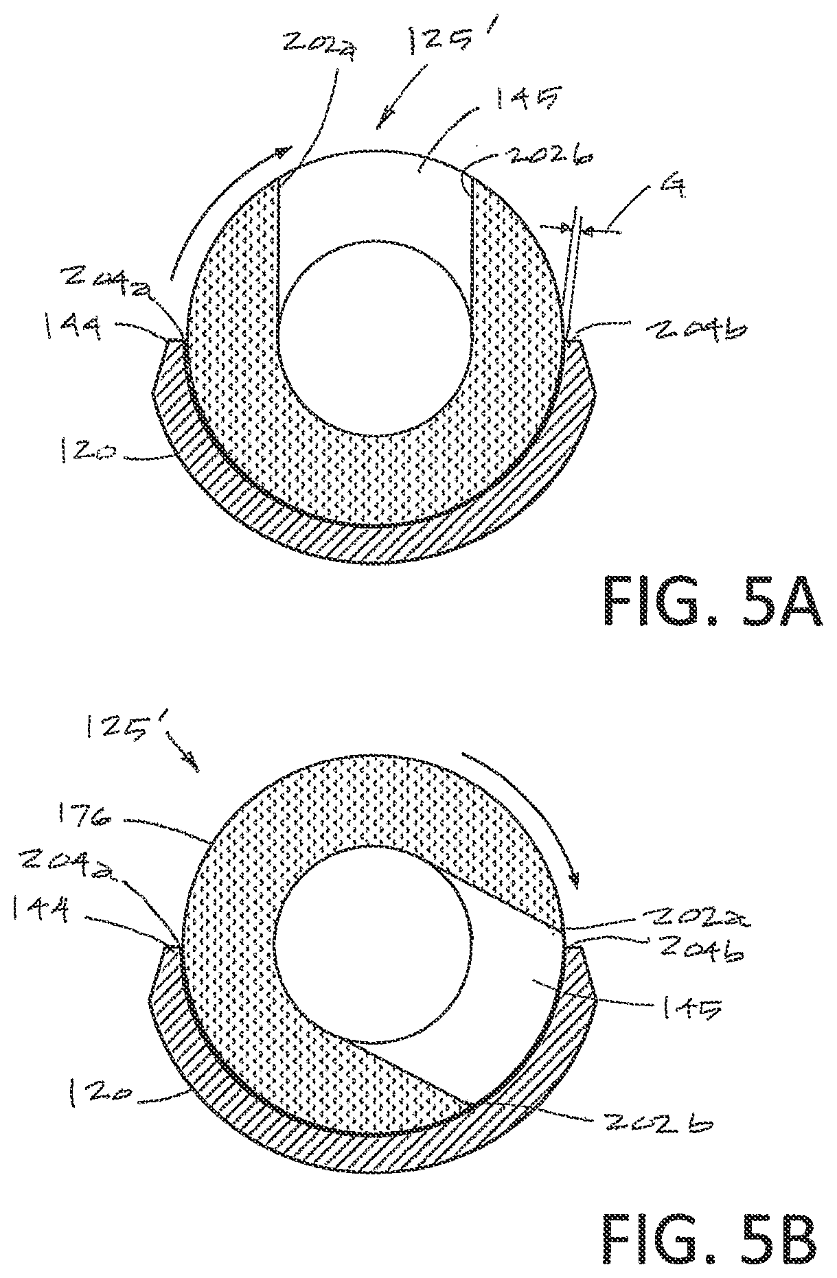 Patent US12096969 Figure 5 – Arthroscopic devices and methods