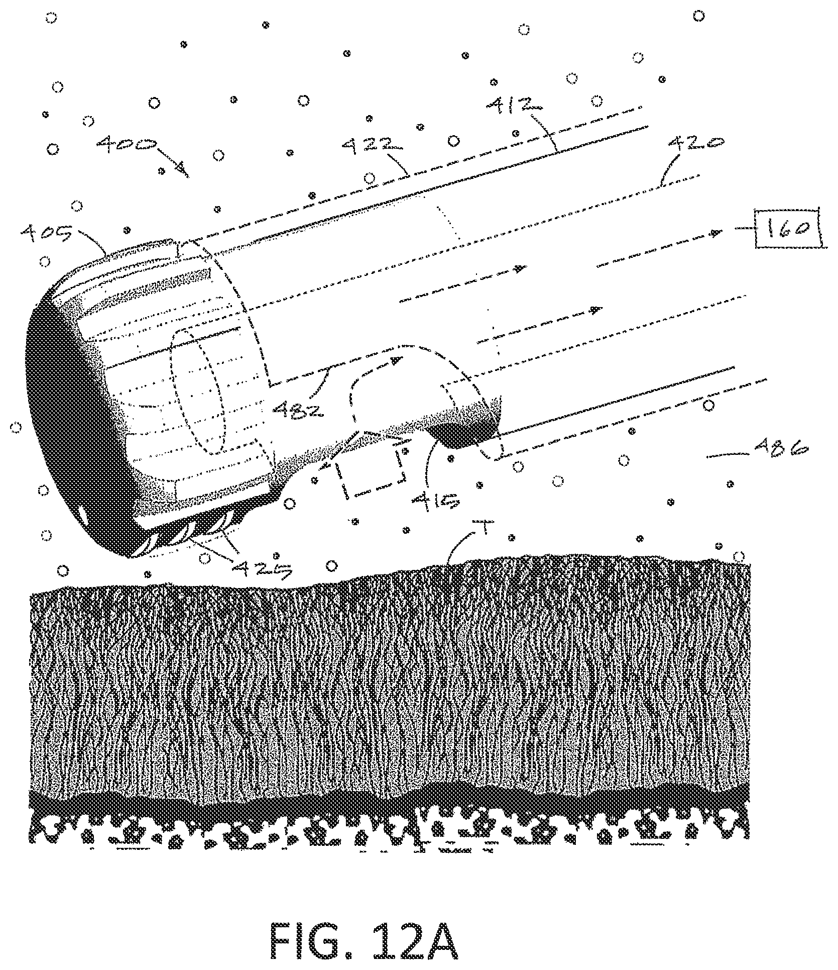 Patent US12096969 Figure 12 – Arthroscopic devices and methods