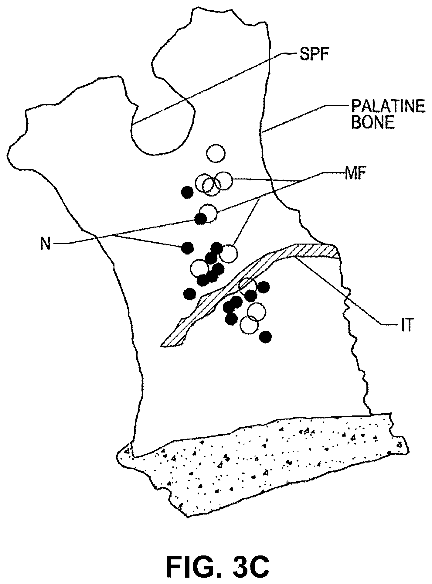 Patent US12096974 Figure 5 – Systems and methods for therapeutic nasal treatment using handheld device
