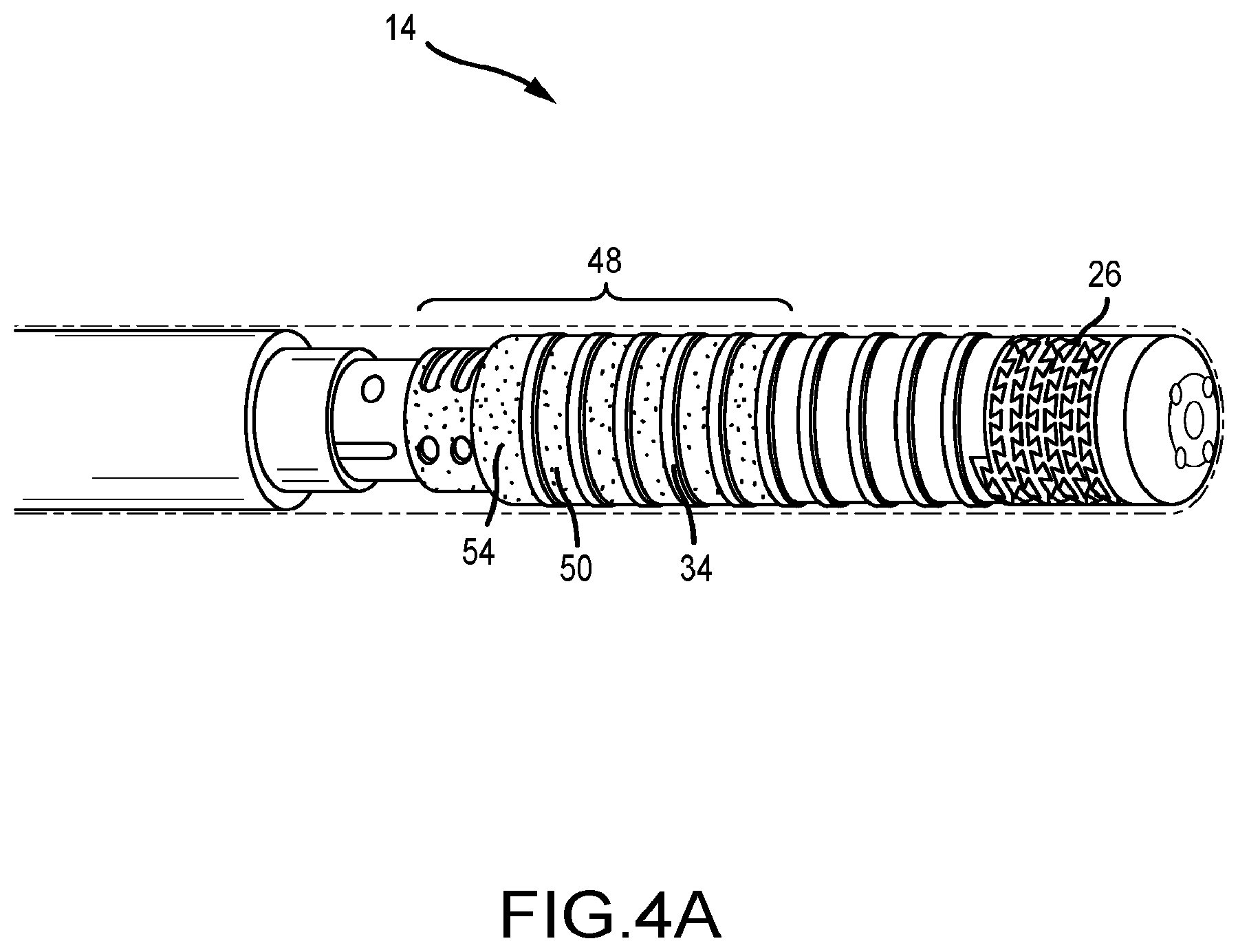 Patent US12096977 Figure 5 – Electrophysiology catheter with modular electrode structure