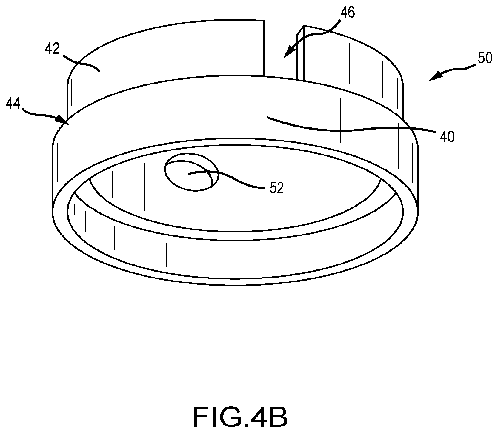 Patent US12096977 Figure 6 – Electrophysiology catheter with modular electrode structure