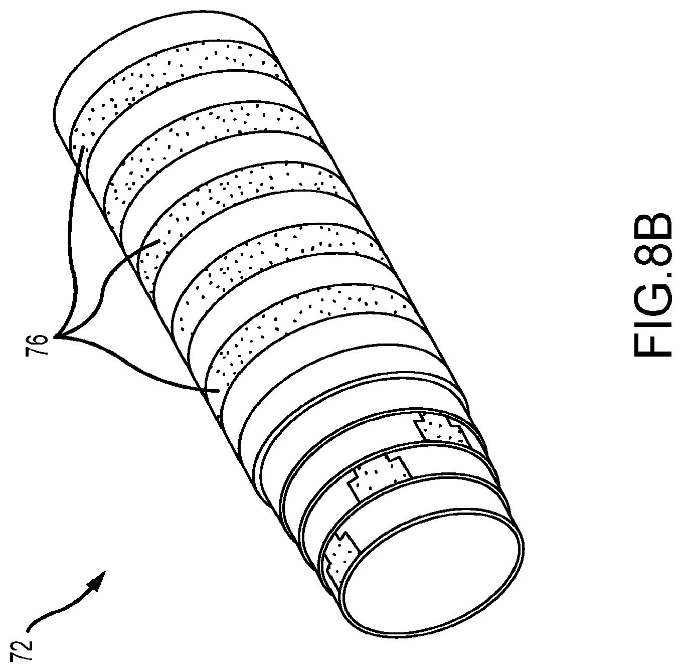 Patent US12096977 Figure 13 – Electrophysiology catheter with modular electrode structure