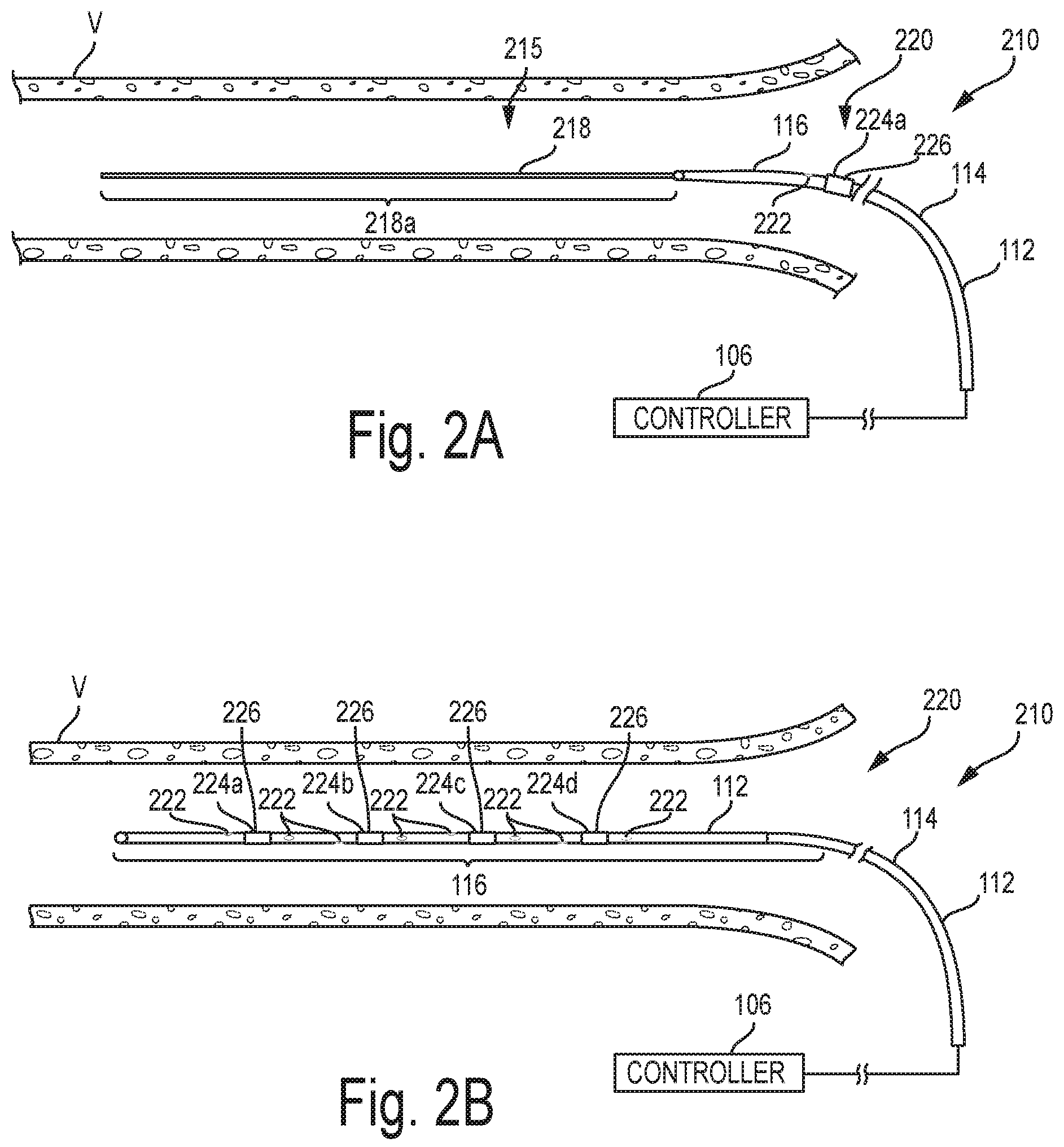 Patent US12096978 Figure 2 – Controlled irrigation for neuromodulation systems and associated methods