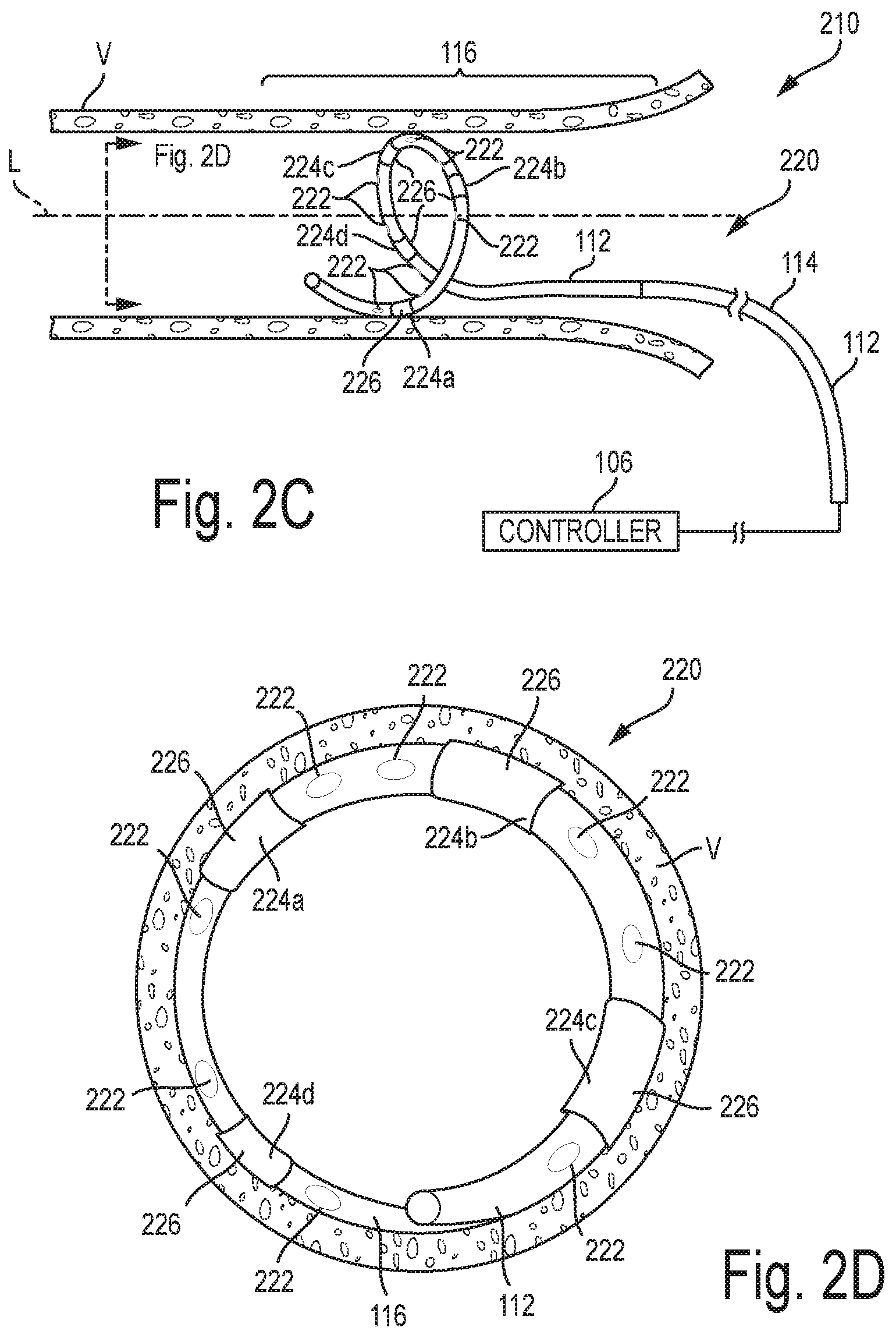 Patent US12096978 Figure 3 – Controlled irrigation for neuromodulation systems and associated methods