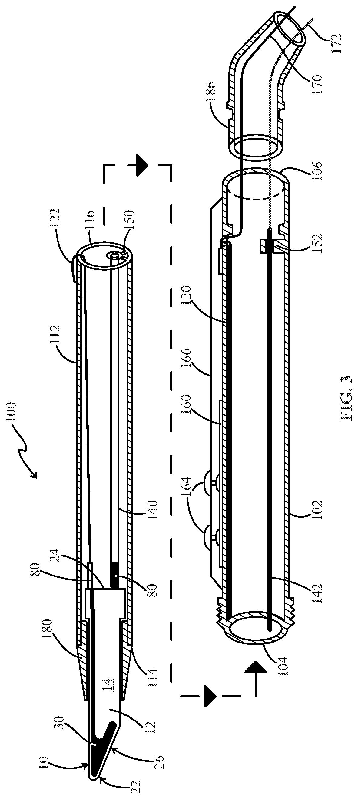Patent US12096979 Figure 3 – Ultrapolar telescopic electrosurgery pencil and ultrapolar electrosurgery blade