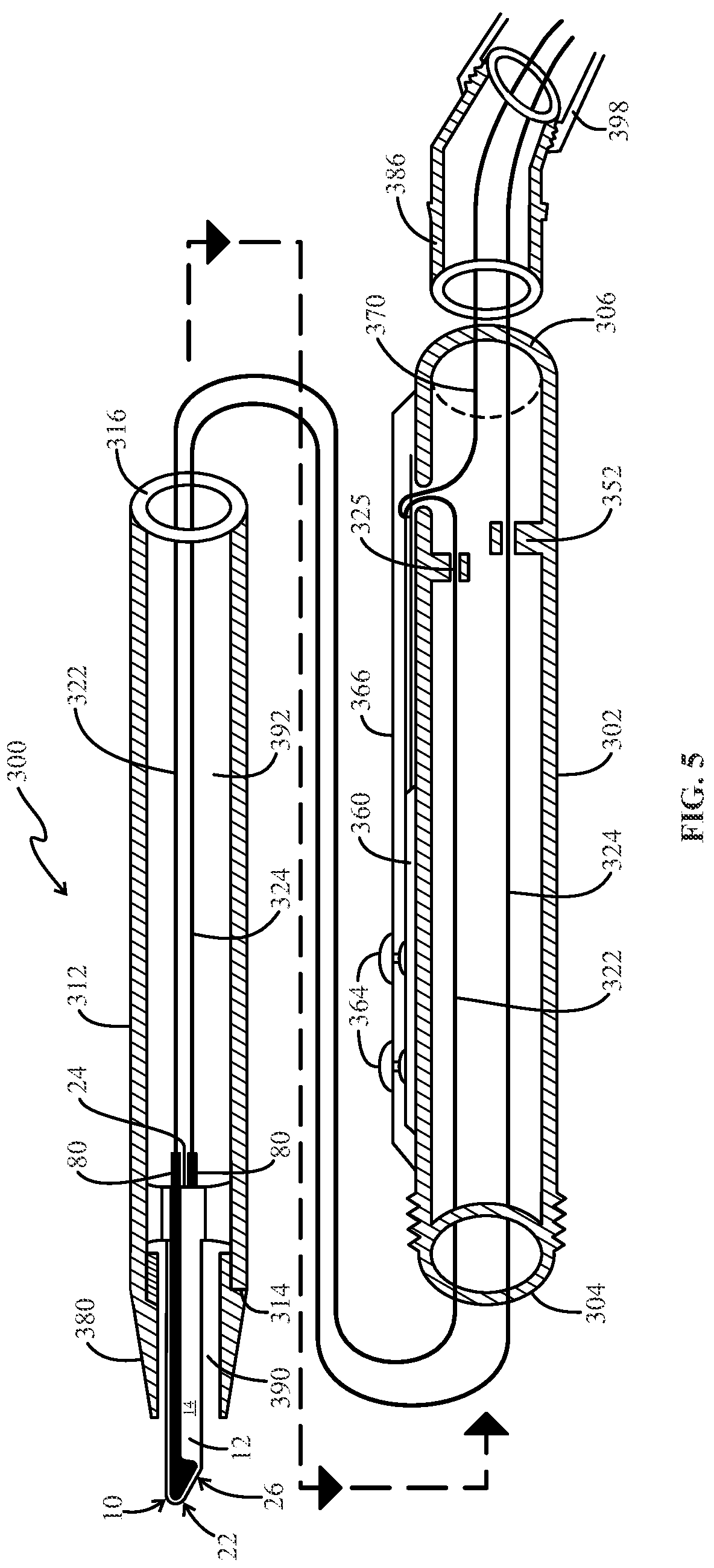 Patent US12096979 Figure 5 – Ultrapolar telescopic electrosurgery pencil and ultrapolar electrosurgery blade